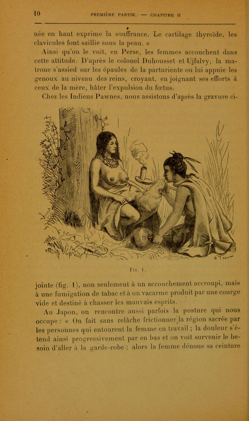 née en haut exprime la souffrance. Le cartilage thyroïde, les clavicules font saillie sous la peau. » Ainsi qu’on le voit, en Perse, les femmes accouchent dans cette attitude. D’après le colonel Duhousset et IJjfalvy, la ma- trone s'assied sur les épaules de la parturiente ou lui appuie les genoux au niveau des reins, croyant, en joignant ses efforts à ceux de la mère, hâter l’expulsion du fœtus. Chez les Indiens Pawnes, nous assistons d’après la gravure ci- Fig. 1. jointe (fig. 1), non seulement à un accouchement accroupi, mais à une fumigation de tabac, et. à un vacarme produit par une courge vide et destiné à chasser les mauvais esprits. Au Japon, on rencontre aussi parfois la posture qui nous occupe : « On fait sans relâche frictionner la région sacrée par les personnes qui entourent la femme en travail ; la douleur s é- tend ainsi progressivement par en bas et on voit survenir le be- soin d’aller à la garde-robe ; alors la femme dénoue sa ceinture