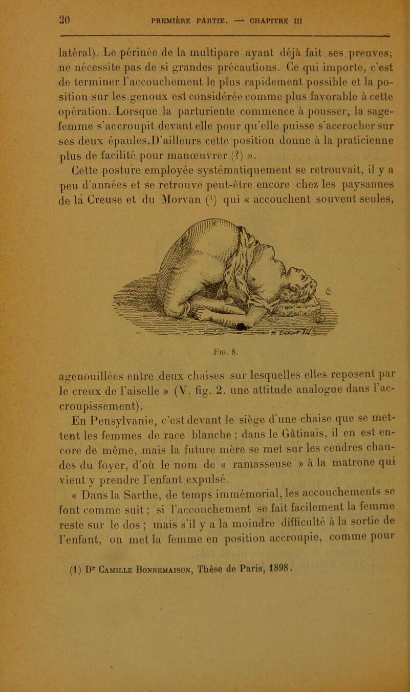 latéral). Le périnée de la multipare ayant déjà fait ses preuves-, 11e nécessite pas de si grandes précautions. Ce qui importe, c’est de terminer l'accouchement le plus rapidement possible et la po- sition sur les genoux est considérée comme plus favorable à cette opération. Lorsque la parturiente commence à pousser, la sage- femme s’accroupit devant elle pour qu'elle puisse s'accrocher sur ses deux épaules. D’ailleurs cette position donne à la praticienne plus de facilité pour manœuvrer (?) ». Cette posture employée systématiquement se retrouvait, il y a peu d’années et se retrouve peut-être encore chez les paysannes de la Creuse et du Morvan (*) qui « accouchent souvent seules, Fig. S. agenouillées entre deux chaises sur lesquelles elles reposent par le creux de l’aiselle » (V. fîg. 2. une attitude analogue dans 1 ac- croupissement). En Pcnsylvanie, c’est devant le siège d une chaise que se met- tent les femmes de race blanche ; dans le Gâtinais, il en est en- core de même, mais la future mère se met sur les cendres chau- des du foyer, d'où le nom de « ramasseuse » a la matrone qui vient y prendre l'enfant expulsé. « Dans la Sarthe, de temps immémorial, les accouchements se font comme suit; si l’accouchement se fait facilement la femme reste sur le dos ; mais s il y a la moindre difficulté a la sortie de l’enfant, on met la femme en position accroupie, comme pour (1) Dr Camille Bonnemaison, Thèse de Paris, 1898.