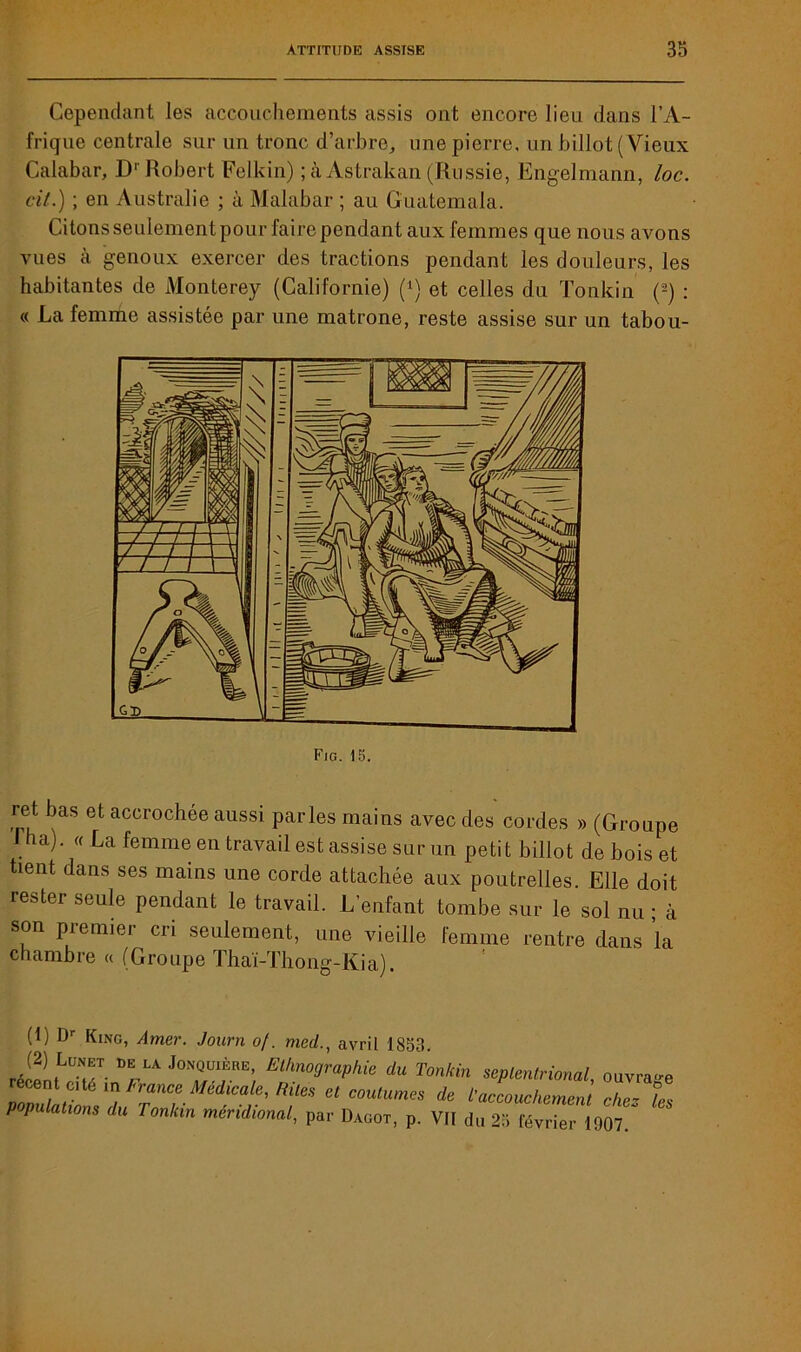 Cependant les accouchements assis ont encore lien dans l’A- frique centrale sur un tronc d’arbre, une pierre, un billot (Vieux Calabar, D' Robert Felkin) ; à Astrakan (Russie, Engelmann, loc. ci/.) ; en Australie ; à Malabar ; au Guatemala. Citons seulement pour faire pendant aux femmes que nous avons vues à genoux exercer des tractions pendant les douleurs, les habitantes de Monterey (Californie) (*) et celles du Tonkin (2) : « La femme assistée par une matrone, reste assise sur un tabou- Fig. 13. ret bas et accrochée aussi parles mains avec des cordes » (Groupe J ha). « La femme en travail est assise sur un petit billot de bois et tient dans ses mains une corde attachée aux poutrelles. Elle doit rester seule pendant le travail. L’enfant tombe sur le sol nu ; à son premier cri seulement, une vieille femme rentre dans la chambre « (Groupe Thaï-Thong-Kia) (t) Dr King, Amer. Journ 0/. med., avril 1853. LA J°NQÜIfRE> ElknoOrphie du Tonkin septentrional, ouvrage ci a in l'rance Médicale, Rites et coutumes de l'accouchement che~ tes populations du Tonkin méridional, par Dagot, p. VII du 2b févr^r 1907