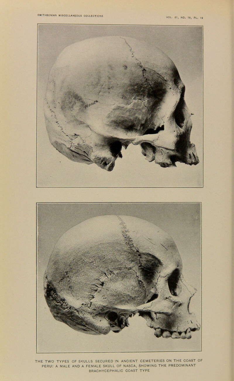 VOL. 01, NO. 18, PL, te THE TWO TYPES OF SKULLS SECURED IN ANCIENT CEMETERIES ON THE COAST OF PERU: A MALE AND A FEMALE SKULL OF NASCA, SHOWING THE PREDOMINANT BRACHYCEPHALIC COAST TYPE