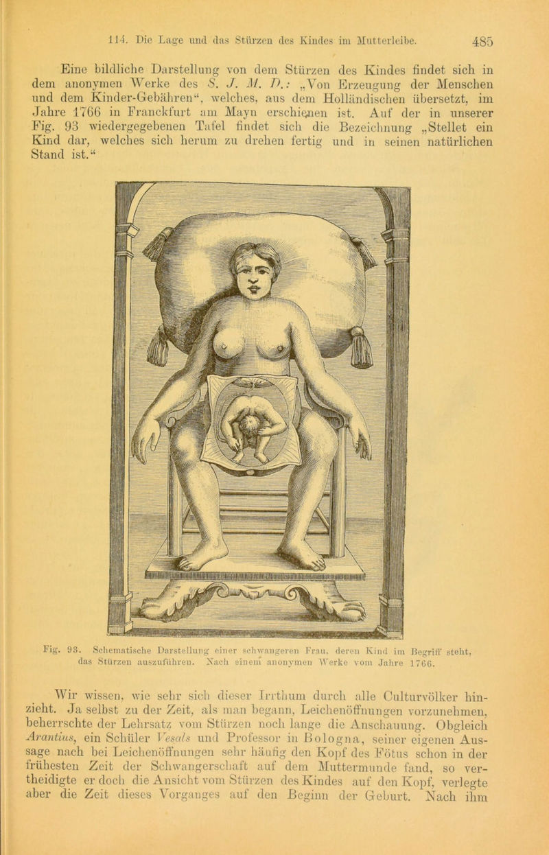 Eine bildliche Darstellung von dem Stürzen des Kindes findet sich in dem anonymen Werke des 5. J. M. D,: „Von Erzeugung der Menschen und dem Kinder-Gebähren“, welches, aus dem Holländischen übersetzt, im Jahre 1766 in Franckfurt am Mayn erschienen ist. Auf der in unserer Fig. 93 wiedergegebenen Tafel findet sich die Bezeichnung „Stellet ein Kind dar, welches sich herum zu drehen fertig und in seinen natürlichen Stand ist.“ 93. Schematische Darstellung einer schwangeren Frau, deren Kind im das Stürzen auszuführen. Nach einem anonymen Werke vom Jahre Begriff steht, 1766. Wir wissen, wie sehr sich dieser Irrthum durch alle Culturvölker hin- zieht. Ja selbst zu der Zeit, als man begann, Leichenöffnungen vorzunehmen, beherrschte der Lehrsatz vom Stürzen noch lange die Anschauung. Obgleich Arantius, ein Schüler Vesals und Professor in Bologna, seiner eigenen Aus- sage nach bei Leichenöffnungen sehr häufig den Kopf des Fötus schon in der frühesten Zeit der Schwangerschaft auf dem Muttermunde fand, so ver- theidigte er doch die Ansicht vom Stürzen des Kindes auf den Kopf, verlegte aber die Zeit dieses Vorganges auf den Beginn der Geburt. Nach ihm