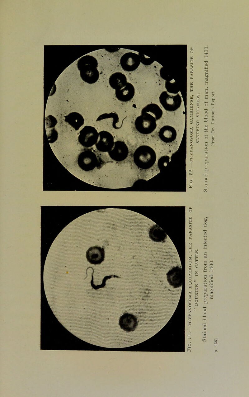 51- TRYPANOSOMA EQUIPERDUM, THE PARASITE OF FrO. 52. TRYPANOSOMA GAMBIENSE, THE PARASITE OF “ DOURINE ” IN CATTLE. SLEEPING SICKNESS. Stained blood preparation from an infected dog, Stained preparation of the blood of man, magnified 1400. magnified 1400. From Dr. Dutton’s Report.