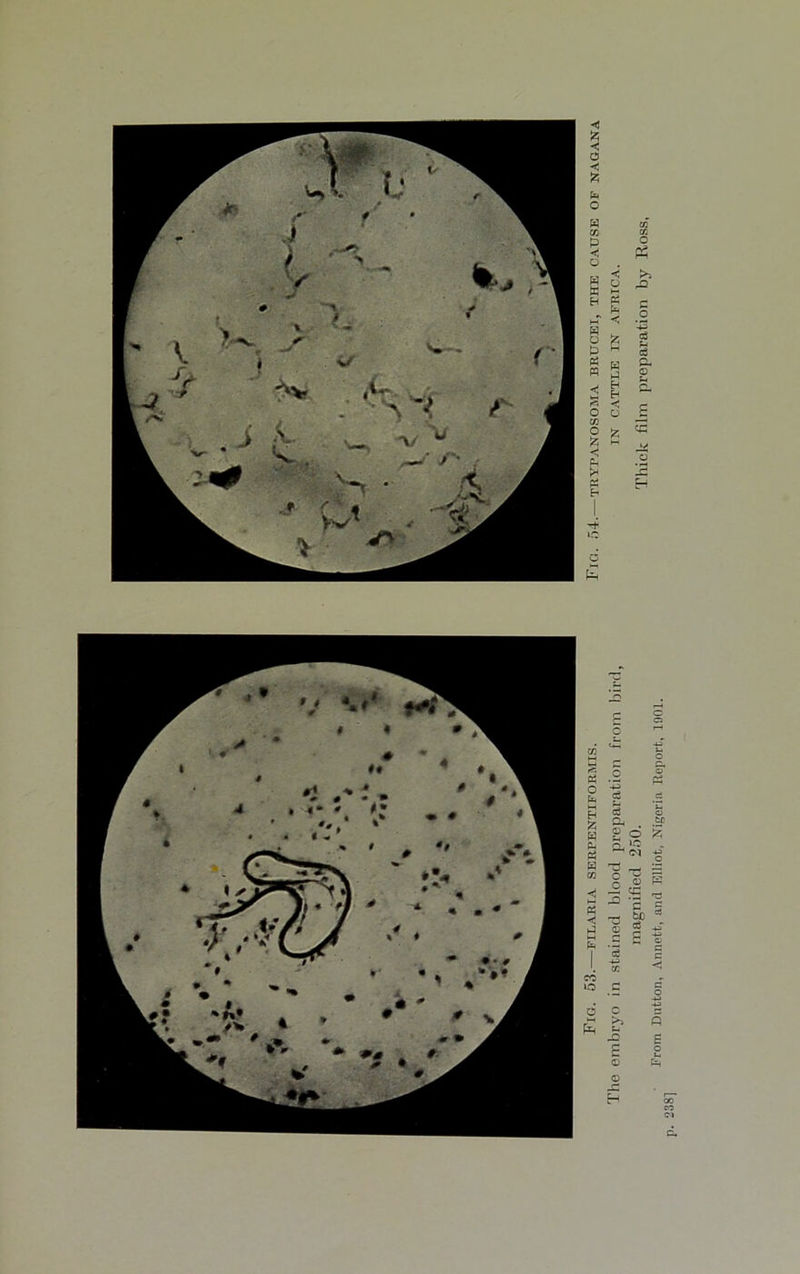 The embryo in stained blood preparation from bird, tn cattle in Africa. magnified 250. Thick film preparation by Ross, From Dutton, Annett, and Elliot, Nigeria Report, 1901.