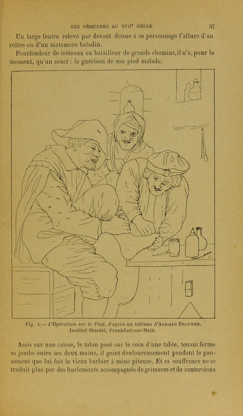 Un large feutre relevé par devant donne à ce personnage l’allure d’un reître ou d’un matamore baladin. Pourfendeur de tréteaux ou batailleur de grands chemins,il n’a, pour le moment, qu’un souci : la guérison de son pied malade. Fig. 4.— L’Opération sur le Pied, d’après un tableau d’ÂDRiAEN Brouwer. Institut Staedel, Frankfort-sur-Main. Assis sur une caisse, le talon posé sur le coin d’une table, tenant ferme sa jambe entre ses deux mains, il geint douloureusement pendant le pan- sement que lui fait le vieux barbier à mine piteuse. Et sa souffrance ne se traduit plus par des hurlements accompagnés de grimaces et de contorsions