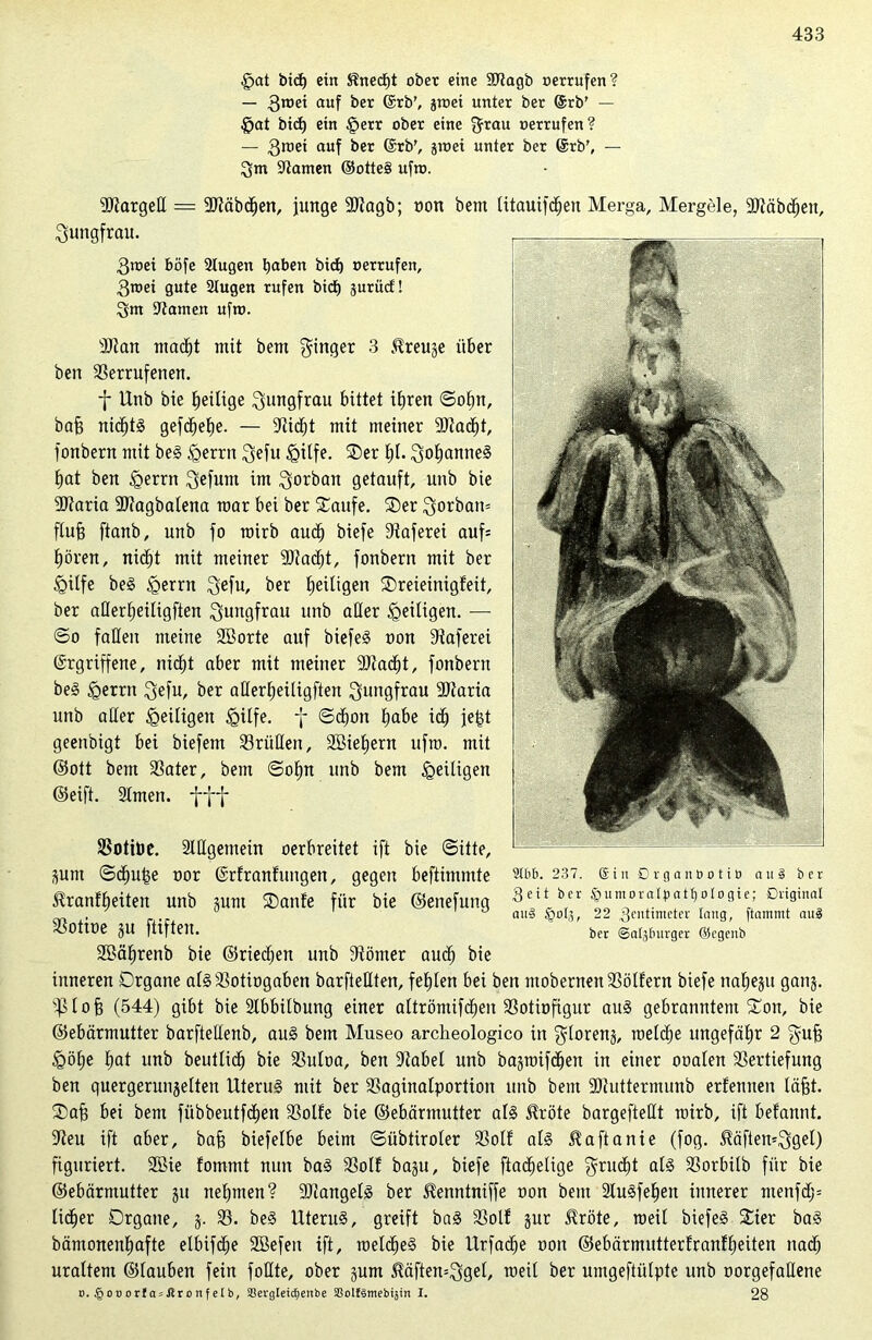 §at bicf) ein Knecht ober eine Vtagb »errufen? — 3n,ei auf ber @rb', St»et unter ber @rb’ — fjat bid) ein §err ober eine grau »errufen? — gmei auf ber Erb', gioei unter ber Erb', — gm tarnen ©otte§ uft». 3Jtargeß = 9)täbdjen, junge SJiagb; wort bem litauifdjeit Merga, Mergele, 3Jtäbd)en, gungfrau. 3t»ei böfe 2lugen haben bid) »errufen, groei gute 2tugen rufen bid) gurud! gm ÜJtamen ufro. 3Jian ntad)t mit bem ginger 3 $reuge über ben Verrufenen. f Unb bie ^eilige gungfrau bittet ifjren ©ol»n, baB nidjtg gefd)el)e. — 9iid)t mit meiner 9)tad)t, fonbern mit beg &errn geftt igitfe. Ser 1)1- goljantteg bjat ben §errn gefüllt im gorbait getauft, unb bie •äftaria 2J?agbaIena mar bei ber Saufe. Ser gorbam ftuB ftanb, unb fo mirb aud) biefe Vaferei auf= tjören, nidjt mit meiner 2D?ad)t, fonbern mit ber £>üfe beg Igerrn gefu, ber fjeitigen Sreieinigfeit, ber aÜertjeiligften guitgfrau unb aller ^eiligen. — ©o fallen meine Söorte auf biefeg non Diaferei Ergriffene, nicfjt aber mit meiner 9)tad)t, fonbern beg <gernt gefu, ber aHertjeiligften gungfrau 9)taria unb aller ^eiligen §ilfe. f ©d)on Babe idj jef$t geenbigt bei biefent Vriißen, SBieljern ufro. mit ©ott bem Vater, bem ©olm unb bem ^eiligen ©eift. 2lmett. Votitoe. aiHgemein oerbreitet ift bie ©itte, Sunt ©cf)u£e oor Erfranfungen, gegen beftimmte 9tu&- 237. einörganootio aus ber ^ranffjeiten unb gunt Sanfe für bie ©enefung ^et*b,er ®“m0raIpatf)0l09ie; 0n9inaI . ° au3 §oI,5, 22 gentuneter lang, ftammt auä Votiüe JU ftlfteit. ber ©aljlnirger @cgenb Söäljrenb bie ©rieten unb Vömer aud; bie inneren Drgane algVotiogaben barfteßten, fehlen bei ben ntoberneit Völfern biefe na^e§tt gans. sj3loB (544) gibt bie Stbbilbung einer altröntifd)en Votiofigur aug gebranntem Son, bie ©ebärmutter barfteßenb, aug bem Museo archeologico in gloreng, ioeld)e ungefähr 2 guB §öt)e f)at unb beutlid) bie Vuloa, ben Vabet unb bagioifd)en in einer ooaten Vertiefung ben quergerunselten Uterug mit ber Vagiitalportioit unb beut 9)hitterntunb erlernten läBt. SaB bei bent fübbeutfdjen Volte bie ©ebärmutter alg $röte bargefteßt toirb, ift befaitnt. Veu ift aber, baB biefelbe beim ©übtiroler Volt alg ^aftanie (fog. ^äftemggel) figuriert. Sßie fommt nun bag Volt bagu, biefe ftadjelige grud)t alg Vorbilb für bie ©ebärmutter gu neunten ? Viangelg ber ^enntniffe oon bem 2lugfeE»eit innerer ntenfd;= lieber Drgane, g. V. beg Uterug, greift bag Volt gut $röte, roeil biefeg Sier bag bämonenlmfte elbifdje Sßefeit ift, toeldieg bie Urfadje oon ©ebärmuttertranfljeiten nad; uraltem ©tauben fein foßte, ober gunt $äften=ggel, loeü ber untgeftülpte unb oorgefaßene o. §0oorf asJtronfetb, a3ergteicf)enbe aSolfSmebijin I. 28