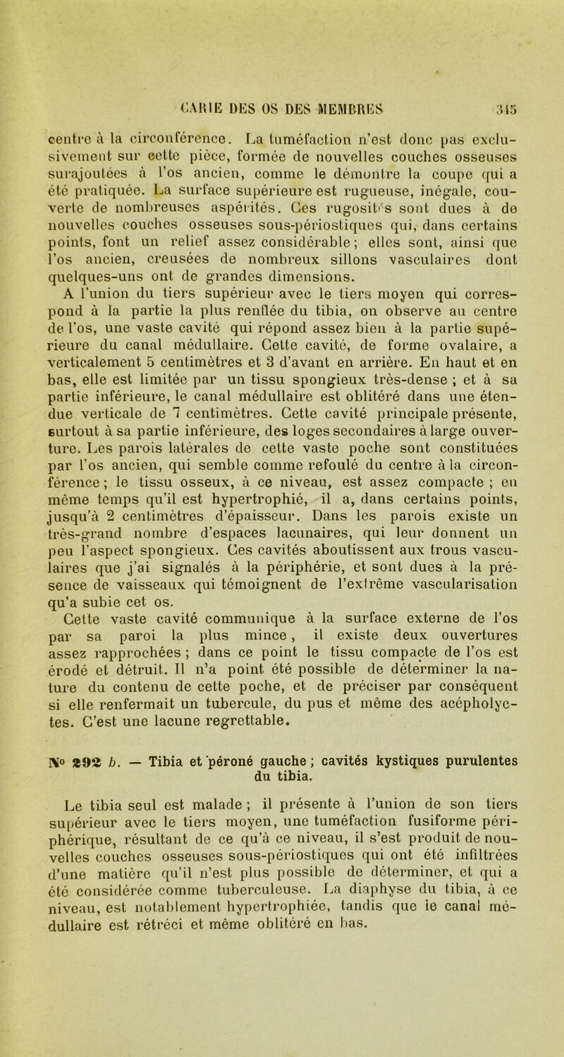 centre à la circonférence. La tuméfaction n’est donc pas exclu- sivement sur cette pièce, formée de nouvelles couches osseuses surajoutées à l’os ancien, comme le démontre la coupe qui a été pratiquée. La surface supérieure est rugueuse, inégale, cou- verte de nombreuses aspérités. Ces rugosités sont dues à do nouvelles couches osseuses sous-périostiques qui, dans certains points, font un relief assez considérable; elles sont, ainsi que l’os ancien, creusées de nombreux sillons vasculaires dont quelques-uns ont de grandes dimensions. A l’union du tiers supérieur avec le tiers moyen qui corres- pond à la partie la plus renflée du tibia, on observe au centre de l’os, une vaste cavité qui répond assez bien à la partie supé- rieure du canal médullaire. Cette cavité, de forme ovalaire, a verticalement 5 centimètres et 3 d’avant en arrière. En haut et en bas, elle est limitée par un tissu spongieux très-dense ; et à sa partie inférieure, le canal médullaire est oblitéré dans une éten- due verticale de 1 centimètres. Cette cavité principale présente, surtout à sa partie inférieure, des loges secondaires à large ouver- ture. Les parois latérales de cette vaste poche sont constituées par l’os ancien, qui semble comme refoulé du centre à la circon- férence ; le tissu osseux, à ce niveau, est assez compacte ; en même temps qu’il est hypertrophié, il a, dans certains points, jusqu’à 2 centimètres d’épaisseur. Dans les parois existe un très-grand nombre d’espaces lacunaires, qui leur donnent un peu l’aspect spongieux. Ces cavités aboutissent aux trous vascu- laires que j’ai signalés à la périphérie, et sont dues à la pré- sence de vaisseaux qui témoignent de l’extrême vascularisation qu’a subie cet os. Cette vaste cavité communique à la surface externe de l’os par sa paroi la plus mince , il existe deux ouvertures assez rapprochées ; dans ce point le tissu compacte de l’os est érodé et détruit. Il n’a point été possible de déterminer la na- ture du contenu de cette poche, et de préciser par conséquent si elle renfermait un tubercule, du pus et même des acépholyc- tes. C’est une lacune regrettable. N° *92 b. — Tibia et péroné gauche; cavités kystiques purulentes du tibia. Le tibia seul est malade ; il présente à l’union de son tiers supérieur avec le tiers moyen, une tuméfaction fusiforme péri- phérique, résultant de ce qu’à ce niveau, il s’est produit de nou- velles couches osseuses sous-périostiques qui ont été infiltrées d’une matière qu’il n’est plus possible de déterminer, et qui a été considérée comme tuberculeuse. La diaphyse du tibia, à ce niveau, est notablement hypertrophiée, tandis que ie canal mé- dullaire est rétréci et même oblitéré en bas.