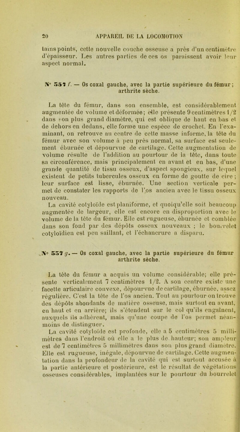 tains points, cotte nouvelle couche osseuse a près d’un centimètre d’épaisseur. Les autres parties de ces os paraissent avoir leur aspect normal. 559 /’. — Os coxal gauche, avec la partie supérieure du fémur; arthrite sèche. La tête du fémur, dans son ensemble, est considérablement augmentée de volume etdéformée; elle présente 9centimètres 1/2 dans son plus grand diamètre, qui est oblique de haut en bas et de dehors en dedans, elle forme une espèce de crochet. En l’exa- minant, on retrouve au centre de cette masse informe, la tête du fémur avec son volume à peu près normal, sa surface est seule- ment éburnée et dépourvue de cartilage. Cette augmentation de volume résulte de l’addition au pourtour de la tête, dans toute sa circonférence, mais principalement en avant et en bas, d’une grande quantité de tissu osseux, d’aspect spongieux, sur lequel existent de petits tubercules osseux en forme de goutte de cire ; leur surface est lisse, éburnée. Une section verticale per- met de constater les rapports de l’os ancien avec le tissu osseux nouveau. La cavité cotyloïde est planiforme, et quoiqu’elle soit beaucoup augmentée de largeur, elle est encore en disproportion avec le volume de la tète du fémur. Elle est rugueuse, éburnée et comblée dans son fond par des dépôts osseux nouveaux ; le bourrelet cotyloïdien est peu saillant, et l'échancrure a disparu. 1\’° SS? g.— Os coxal gauche, avec la partie supérieure du fémur arthrite sèche. La tête du fémur a acquis un volume considérable; elle pré- sente verticalement 7 centimètres 1/2. A son centre existe une facette articulaire convexe, dépourvue de cartilage, éburnée, assez régulière. C’est la tète de l’os ancien. Tout au pourtour on trouve des dépôts abondants de matière osseuse, mais surtout en avant, en haut et en arrière; ils s’étendent sur le col qu’ils engaînent, auxquels ils adhèrent, mais qu’une coupe de l’os permet néan- moins de distinguer. La cavité cotyloïde est profonde, elle a 5 centimètres 5 milli- mètres dans l’endroit où elle a le plus de hauteur; son ampleur est de 7 centimètres 5 millimètres dans son plus grand diamètre. Elle est rugueuse, inégale, dépourvue de cartilage. Cette augmen- tation dans la profondeur de la cavité qui est surtout accusée à la partie antérieure et postérieure, est le résultat de végétations osseuses considérables, implantées sur le pourtour du bourrelet