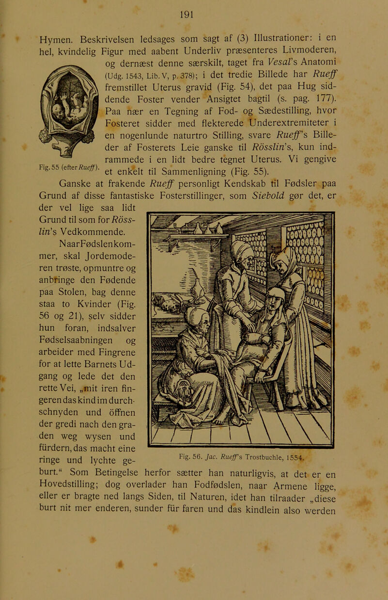 Hymen. Beskrivelsen ledsages som sagt af (3) Illustrationer: i en hel, kvindelig Figur med aabent Underliv præsenteres Livmoderen, og dernæst denne særskilt, taget fra VesaVs Anatomi (Udg. 1543, Lib.v, p. 378); i det tredie Billede har Ruejf fremstillet Uterus gravid (Fig. 54), det paa Hug sid- dende Foster vender Ansigtet bagtil (s. pag. 177). Paa nær en Tegning af Fod- og Sædestilling, hvor Fosteret sidder med flekterede Underextremiteter i en nogenlunde naturtro Stilling, svare Ruejf's Bille- der af Fosterets Leie ganske til Rdsslin's, kun ind- rammede i en lidt bedre tegnet Uterus. Vi gengive Fig.55 (efteriJue#). enkelt til Sammenligning (Fig. 55). Ganske at frakende Ruejf personligt Kendskab til Fødsler paa Grund af disse fantastiske Fosterstillinger, som Siehold gør det, er der vel lige saa lidt Grund til som for Rdss- lin's Vedkommende. NaarFødslenkom- mer, skal Jordemode- ren trøste, opmuntre og anbringe den Fødende paa Stolen, bag denne staa to Kvinder (Fig. 56 og 21), selv sidder hun foran, indsalver Fødselsaabningen og arbeider med Fingrene for at lette Barnets Ud- gang og lede det den rette Vei, „mit iren fin- geren das kind im durch- schnyden und offnen der gredi nach den gra- den weg wysen und furdern,das macht eine ringe und lychte ge- burt.“ Som Betingelse herfor sætter han naturligvis, at det er en Hovedstilling; dog overlader han Fodfødslen, naar Armene ligge, eller er bragte ned langs Siden, til Naturen, idet han tilraader „diese burt nit mer enderen, sunder fur faren und das kindlein also werden Fig. 56. Jac. Rueff’s Trostbuchie, 1554.