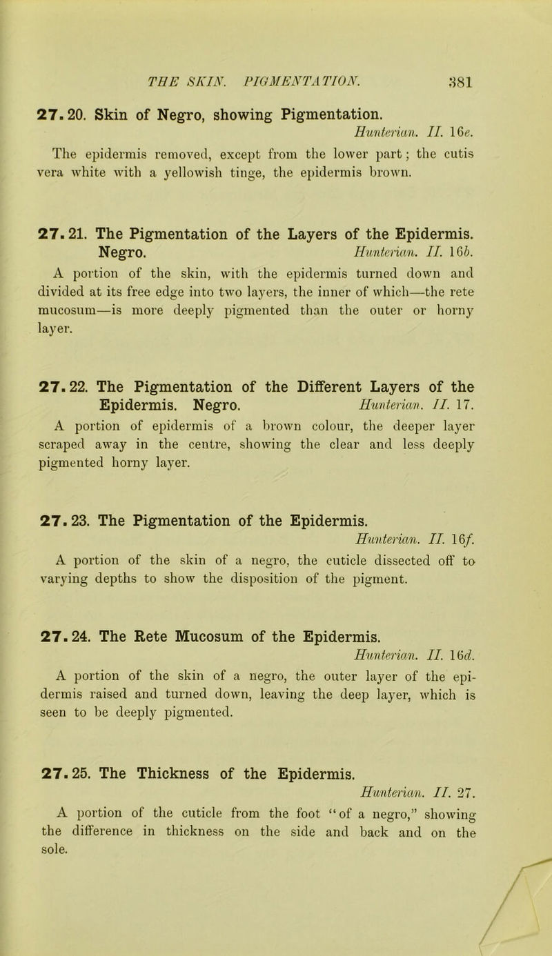 27.20. Skin of Negro, showing Pigmentation. Hunterian. II. I6e. The epidermis removed, except from the lower part; the cutis vera white with a yellowish tinge, the epidermis brown. 27.21. The Pigmentation of the Layers of the Epidermis. Negro. Hunterian. II. 165. A portion of the skin, with the epidermis turned down and divided at its free edge into two layers, the inner of which—the rete mucosum-—is more deeply pigmented than the outer or horny layer. 27.22. The Pigmentation of the Different Layers of the Epidermis. Negro. Hunterian. II. 17. A portion of epidermis of a brown colour, the deeper layer scraped away in the centre, showing the clear and less deeply pigmented horny layer. 27.23. The Pigmentation of the Epidermis. Hunterian. II. 16/. A portion of the skin of a negro, the cuticle dissected off to varying depths to show the disposition of the pigment. 27.24. The Rete Mucosum of the Epidermis. Hunterian. II. 16(5. A portion of the skin of a negro, the outer layer of the epi- dermis raised and turned down, leaving the deep layer, which is seen to be deeply pigmented. 27.25. The Thickness of the Epidermis. Hunterian. II. 27. A portion of the cuticle from the foot “of a negro,” showing the difference in thickness on the side and back and on the sole.
