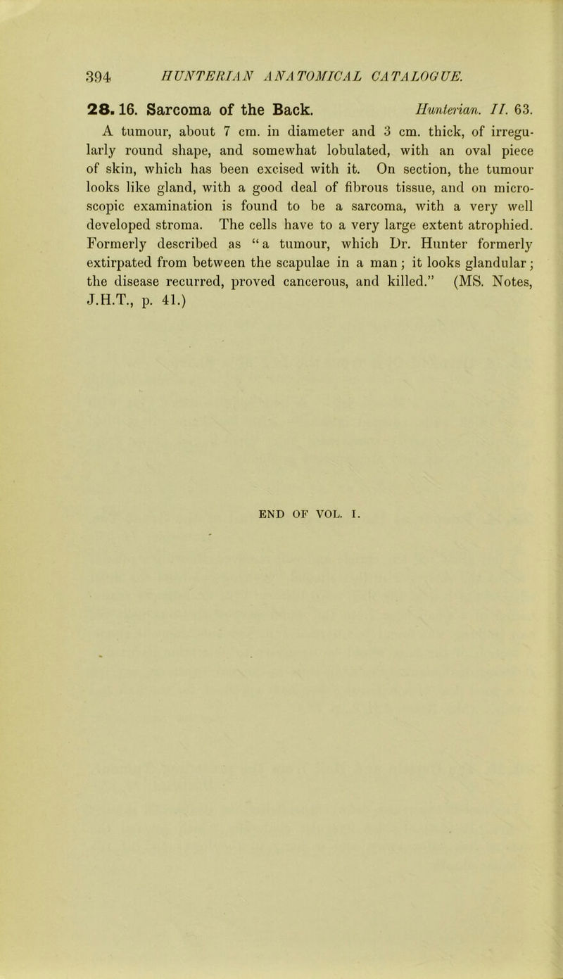 28.16. Sarcoma of the Back. Hunterian. II. 63. A tumour, about 7 cm. in diameter and 3 cm. thick, of irregu- larly round shape, and somewhat lobulated, with an oval piece of skin, which has been excised with it. On section, the tumour looks like gland, with a good deal of fibrous tissue, and on micro- scopic examination is found to be a sarcoma, with a very well developed stroma. The cells have to a very large extent atrophied. Formerly described as “ a tumour, which Dr. Hunter former^ extirpated from between the scapulae in a man ; it looks glandular; the disease recurred, proved cancerous, and killed.” (MS. Notes, J.H.T., p. 41.) END OF VOL. I.