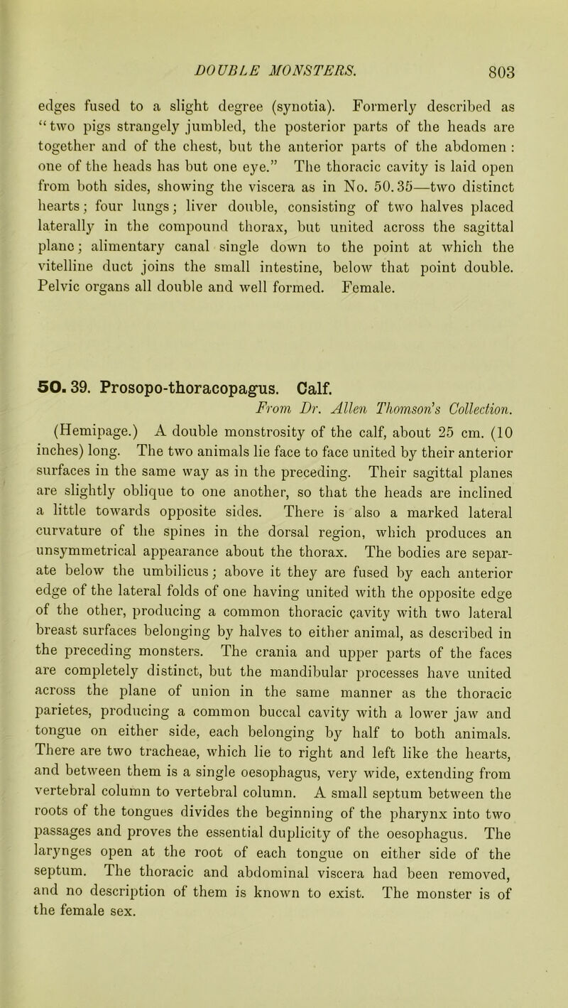 edges fused to a slight degree (synotia). Formerly described as “two pigs strangely jumbled, the posterior parts of the heads are together and of the chest, but the anterior parts of the abdomen : one of the heads has but one eye.” The thoracic cavity is laid open from both sides, showing the viscera as in No. 50.35—two distinct hearts; four lungs; liver double, consisting of two halves placed laterally in the compound thorax, but united across the sagittal plane; alimentary canal single down to the point at which the vitelline duct joins the small intestine, below that point double. Pelvic organs all double and well formed. Female. 50.39. Prosopo-thoracopagus. Calf. From Dr. Allen Thomson's Collection. (Hemipage.) A double monstrosity of the calf, about 25 cm. (10 inches) long. The two animals lie face to face united by their anterior surfaces in the same way as in the preceding. Their sagittal planes are slightly oblique to one another, so that the heads are inclined a little towards opposite sides. There is also a marked lateral curvature of the spines in the dorsal region, which produces an unsymmetrical appearance about the thorax. The bodies are separ- ate below the umbilicus; above it they are fused by each anterior edge of the lateral folds of one having united with the opposite edge of the other, producing a common thoracic cavity with two lateral breast surfaces belonging by halves to either animal, as described in the preceding monsters. The crania and upper parts of the faces are completely distinct, but the mandibular processes have united across the plane of union in the same manner as the thoracic parietes, producing a common buccal cavity with a lower jaw and tongue on either side, each belonging by half to both animals. There are two tracheae, which lie to right and left like the hearts, and between them is a single oesophagus, very wide, extending from vertebral column to vertebral column. A small septum between the roots of the tongues divides the beginning of the pharynx into two passages and proves the essential duplicity of the oesophagus. The larynges open at the root of each tongue on either side of the septum. The thoracic and abdominal viscera had been removed, and no description of them is known to exist. The monster is of the female sex.