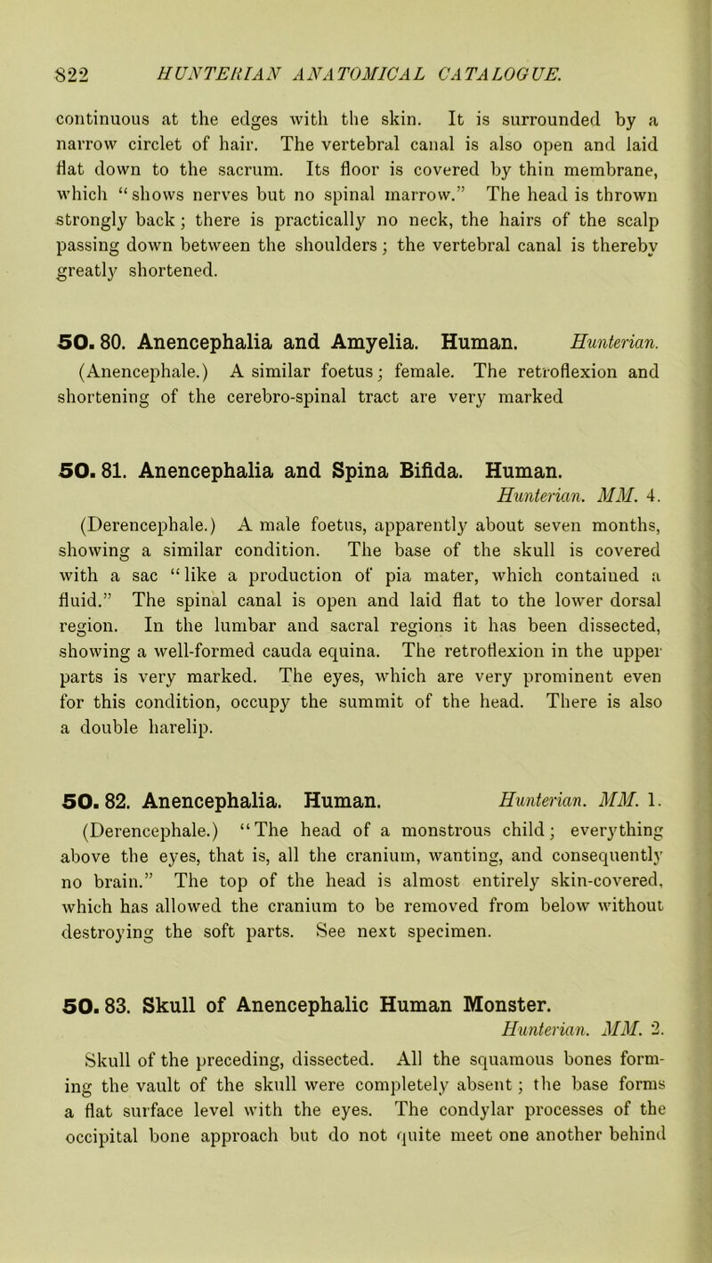 continuous at the edges with the skin. It is surrounded by a narrow circlet of hair. The vertebral canal is also open and laid Hat down to the sacrum. Its floor is covered by thin membrane, which “shows nerves but no spinal marrow.” The head is thrown strongly back ; there is practically no neck, the hairs of the scalp passing down between the shoulders; the vertebral canal is thereby greatly shortened. 50.80. Anencephalia and Amyelia. Human. Hunterian. (Anencephale.) A similar foetus; female. The retroflexion and shortening of the cerebro-spinal tract are very marked 50. 81. Anencephalia and Spina Bifida. Human. Hunterian. MM. 4. (Derencephale.) A male foetus, apparently about seven months, showing a similar condition. The base of the skull is covered with a sac “ like a production of pia mater, which contained a fluid.” The spinal canal is open and laid flat to the lower dorsal region. In the lumbar and sacral regions it has been dissected, showing a well-formed cauda equina. The retroflexion in the upper parts is very marked. The eyes, which are very prominent even for this condition, occupy the summit of the head. There is also a double harelip. 50.82. Anencephalia. Human. Hunterian. MM. 1. (Derencephale.) “The head of a monstrous child; everything above the eyes, that is, all the cranium, wanting, and consequently no brain.” The top of the head is almost entirely skin-covered, which has allowed the cranium to be removed from below without destroying the soft parts. See next specimen. 50. 83. Skull of Anencephalic Human Monster. Hunterian. MM. 2. Skull of the preceding, dissected. All the squamous bones form- ing the vault of the skull were completely absent; the base forms a flat surface level with the eyes. The condylar processes of the occipital bone approach but do not quite meet one another behind