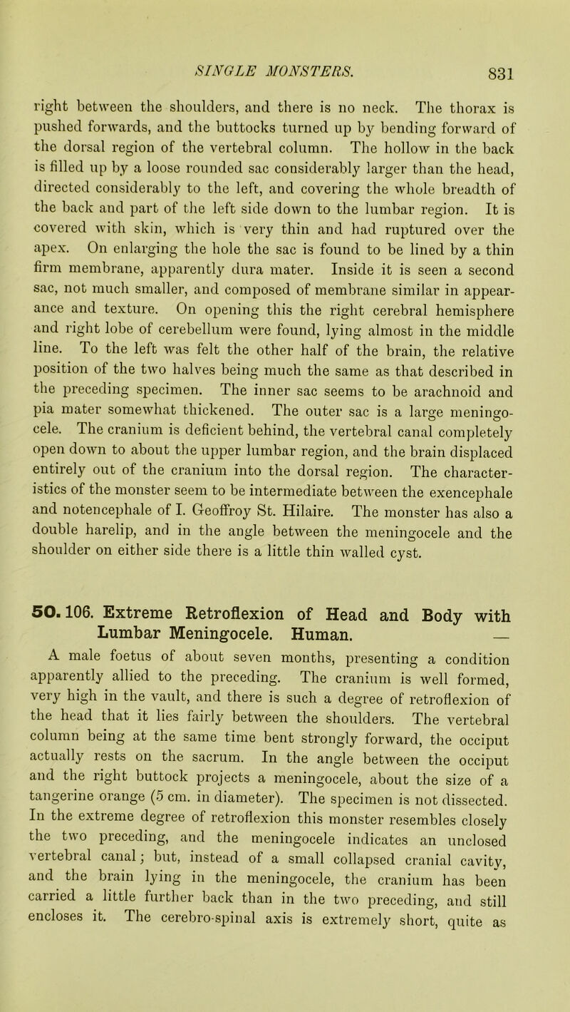 right between the shoulders, and there is no neck. The thorax is pushed forwards, and the buttocks turned up by bending forward of the dorsal region of the vertebral column. The hollow in the back is filled up by a loose rounded sac considerably larger than the head, directed considerably to the left, and covering the whole breadth of the back and part of the left side down to the lumbar region. It is covered with skin, which is very thin and had ruptured over the apex. On enlarging the hole the sac is found to be lined by a thin firm membrane, apparently dura mater. Inside it is seen a second sac, not much smaller, and composed of membrane similar in appear- ance and texture. On opening this the right cerebral hemisphere and right lobe of cerebellum were found, lying almost in the middle line. To the left was felt the other half of the brain, the relative position of the two halves being much the same as that described in the preceding specimen. The inner sac seems to be arachnoid and pia mater somewhat thickened. The outer sac is a large meningo- cele. The cranium is deficient behind, the vertebral canal completely open down to about the upper lumbar region, and the brain displaced entirely out of the cranium into the dorsal region. The character- istics of the monster seem to be intermediate between the exencephale and notencephale of I. G-eofFroy St. Hilaire. The monster has also a double harelip, and in the angle between the meningocele and the shoulder on either side there is a little thin walled cyst. 50.106. Extreme Retroflexion of Head and Body with Lumbar Meningocele. Human. — A male foetus of about seven months, presenting a condition apparently allied to the preceding. The cranium is well formed, very high in the vault, and there is such a degree of retroflexion of the head that it lies fairly between the shoulders. The vertebral column being at the same time bent strongly forward, the occiput actually lests on the sacrum. In the angle between the occiput and the right buttock projects a meningocele, about the size of a tangerine orange (5 cm. in diameter). The specimen is not dissected. In the extreme degree of retroflexion this monster resembles closely the two preceding, and the meningocele indicates an unclosed vertebral canal; but, instead of a small collapsed cranial cavity, and the brain lying in the meningocele, the cranium has been carried a little further back than in the two preceding, and still encloses it. The cerebro spinal axis is extremely short, quite as