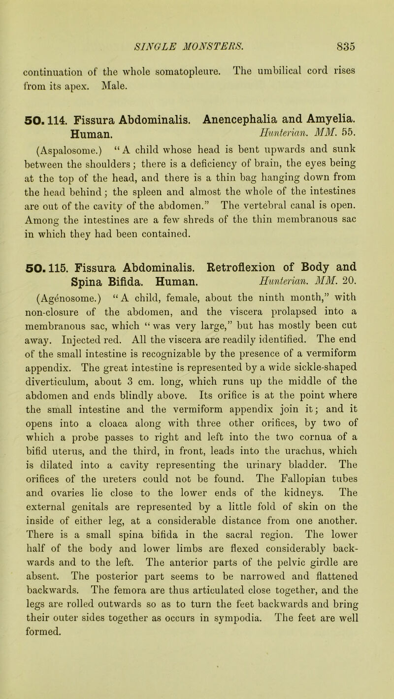 continuation of the whole somatopleure. The umbilical cord rises from its apex. Male. 50.114. Fissura Abdominalis. Anencephalia and Amyelia. Human. Hunterian. MM. 55. (Aspalosome.) “A child whose head is bent upwards and sunk between the shoulders; there is a deficiency of brain, the eyes being at the top of the head, and there is a thin bag hanging down from the head behind; the spleen and almost the whole of the intestines are out of the cavity of the abdomen.” The vertebral canal is open. Among the intestines are a few shreds of the thin membranous sac in which they had been contained. 50.115. Fissura Abdominalis. Retroflexion of Body and Spina Bifida. Human. Hunterian. MM. 20. (Agenosome.) “A child, female, about the ninth month,” with non-closure of the abdomen, and the viscera prolapsed into a membranous sac, which “ was very large,” but has mostly been cut away. Injected red. All the viscera are readily identified. The end of the small intestine is recognizable by the presence of a vermiform appendix. The great intestine is represented by a wide sickle-shaped diverticulum, about 3 cm. long, which runs up the middle of the abdomen and ends blindly above. Its orifice is at the point where the small intestine and the vermiform appendix join it; and it opens into a cloaca along with three other orifices, by two of which a probe passes to right and left into the two cornua of a bifid uterus, and the third, in front, leads into the urachus, which is dilated into a cavity representing the urinary bladder. The orifices of the ureters could not be found. The Fallopian tubes and ovaries lie close to the lower ends of the kidneys. The external genitals are represented by a little fold of skin on the inside of either leg, at a considerable distance from one another. There is a small spina bifida in the sacral region. The lower half of the body and lower limbs are flexed considerably back- wards and to the left. The anterior parts of the pelvic girdle are absent. The posterior part seems to be narrowed and flattened backwards. The femora are thus articulated close together, and the legs are rolled outwards so as to turn the feet backwards and bring their outer sides together as occurs in sympodia. The feet are well formed.