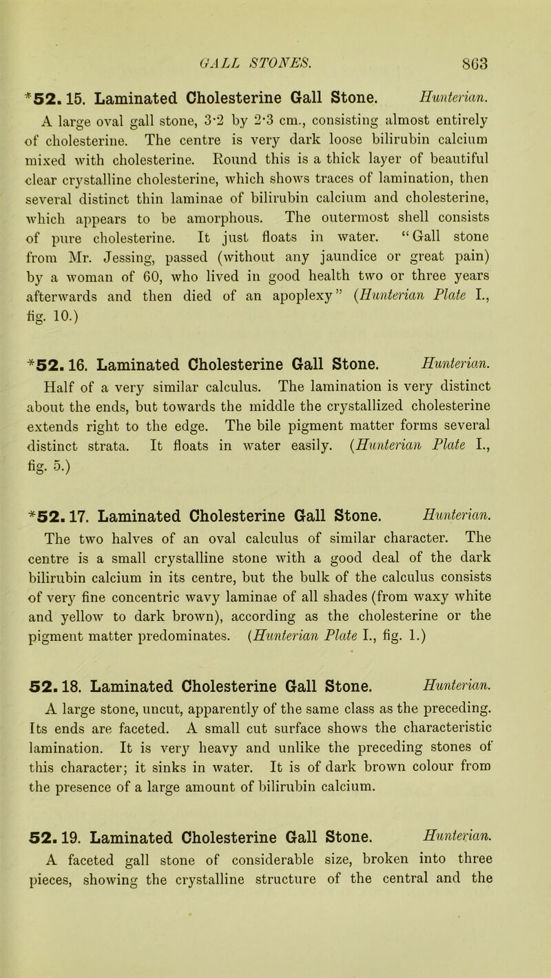 *52.15. Laminated Cholesterine Gall Stone. Hunterian. A large oval gall stone, 3-2 by 2-3 cm., consisting almost entirely of cholesterine. The centre is very dark loose bilirubin calcium mixed with cholesterine. Round this is a thick layer of beautiful clear crystalline cholesterine, which shows traces of lamination, then several distinct thin laminae of bilirubin calcium and cholesterine, which appears to be amorphous. The outermost shell consists of pure cholesterine. It just floats in water. “Gall stone from Mr. Jessing, passed (without any jaundice or great pain) by a woman of 60, who lived in good health two or three years afterwards and then died of an apoplexy” (Hunterian Plate I., fig. 10.) *52.16. Laminated Cholesterine Gall Stone. Hunterian. Half of a very similar calculus. The lamination is very distinct about the ends, but towards the middle the crystallized cholesterine extends right to the edge. The bile pigment matter forms several distinct strata. It floats in water easily. (Hunterian Plate I., fig. 5.) *52.17. Laminated Cholesterine Gall Stone. Hunterian. The two halves of an oval calculus of similar character. The centre is a small crystalline stone with a good deal of the dark bilirubin calcium in its centre, but the bulk of the calculus consists of verjr fine concentric wavy laminae of all shades (from waxy white and yellow to dark brown), according as the cholesterine or the pigment matter predominates. (Hunterian Plate I., fig. 1.) 52.18. Laminated Cholesterine Gall Stone. Hunterian. A large stone, uncut, apparently of the same class as the preceding. Its ends are faceted. A small cut surface shows the characteristic lamination. It is very heavy and unlike the preceding stones of this character; it sinks in water. It is of dark brown colour from the presence of a large amount of bilirubin calcium. 52.19. Laminated Cholesterine Gall Stone. Hunterian. A faceted gall stone of considerable size, broken into three pieces, showing the crystalline structure of the central and the