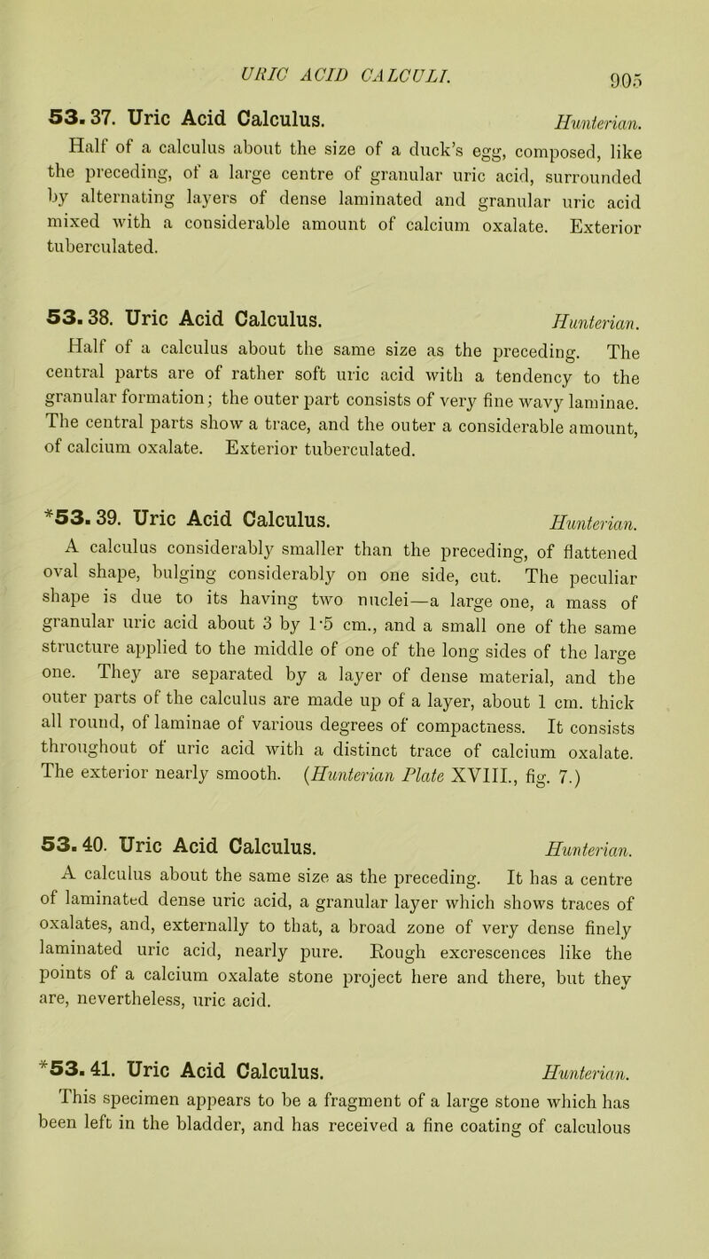 ■53« 37. Uric Acid Calculus. Hunterian. Halt ot a calculus about the size of a duck’s egg, composed, like the preceding, of a large centre of granular uric acid, surrounded by alternating layers of dense laminated and granular uric acid mixed with a considerable amount of calcium oxalate. Exterior tuberculated. 53.38. Uric Acid Calculus. Hunterian. Half of a calculus about the same size as the preceding. The central parts are of rather soft uric acid with a tendency to the granular formation; the outer part consists of very fine wavy laminae. The central parts show a trace, and the outer a considerable amount, of calcium oxalate. Exterior tuberculated. *53. 39. Uric Acid Calculus. Hunterian. A calculus considerably smaller than the preceding, of flattened oval shape, bulging considerably on one side, cut. The peculiar shape is due to its having two nuclei—a large one, a mass of granulai uric acid about i> by 1'5 cm., and a small one of the same structure applied to the middle of one of the long sides of the large one. They are separated by a layer of dense material, and the outer parts of the calculus are made up of’ a layer, about 1 cm. thick all round, of laminae of various degrees of compactness. It consists throughout of uric acid with a distinct trace of calcium oxalate. The exterior nearly smooth. (Hunterian Plate XVIII., fig. 7.) 53.40. Uric Acid Calculus. Hunterian. A calculus about the same size as the preceding. It has a centre of laminated dense uric acid, a granular layer which shows traces of oxalates, and, externally to that, a broad zone of very dense finely laminated uric acid, nearly pure. Hough excrescences like the points of a calcium oxalate stone project here and there, but they are, nevertheless, uric acid. *53.41. Uric Acid Calculus. Hunterian. This specimen appears to be a fragment of a large stone which has been left in the bladder, and has received a fine coating of calculous