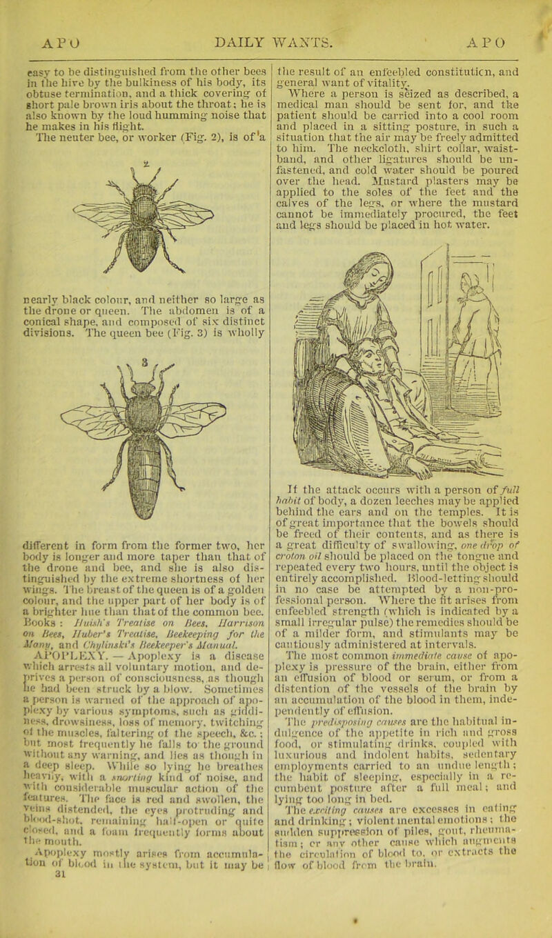 easy to be distinguished from the other bees in (he biro by tlie bulkiness of his body, its obtuse termination, and a thick covering of short pale brown iris about the throat; he is also known by the loud humming noise that he makes in his Hight. llie neuter bee, or worker (Fig. 2), is of a 2. nearly black colour, and neither so large as the drone or queen. The abdomen is of a conical shape, and composed of six distinct divisions. The queen bee (Fig. 3) is wholly different in form from the former two, her body is longer and more taper than that of the drone and bee, and she is also dis- tinguislied by the extreme shortness of her wings. 'The breast of tlie queen is of a golden colour, and the upper part of her body is of a brighter line than that of the common bee. Books ; HuLih's '/'realise on /lees. I/arrison on /iees, J/uber’s Trealise, /iee/ceeping for the i/any, and Chylinski's /leekeeper's A/aiiual. Ai’Of’LKXV. — Apoplexy is a disease whicli arrests all voluntary motion, and de- irivcs a person of consciousness, as though le had been struck liy a blow. Sometimes a person is warned of the approacli of apo- ple.xy by various symptom.s, such as gicldi- iiess, drowsiness, loss of memory, twitching of the mu.Hclcs, faltering of the speech, &c.; but most frequently he falls to the groun(l without any warning, and lies as though in a deep sleep. While so lying he breathes hcavny, with a snurling kind of noi.se, and with considerable muscular action of the features, 'flic face is red and swollen, the veins distended, the eyes protruding and bloisl-shot. remaining hall-open or quite Ciosed, and a foam lrc<tuently forms about the mouth. Apoplexy mostly arises from accumnla-; lion of bl(,od in iiie system, but it may be | the result of an enfeebled constituticn, and general want of vitalitjr. Where a person is seized as described, a medical man sliould be sent for, and the patient should be carried into a cool room and placed in a sitting posture, in such a situation that the air may be freely admitted to him. The neckcloth, .shirt collar, waist- band, and other ligatures should be un- fastened, and cold water should be poured over the head. Mu.stard plasters may be applied to the soles of the feet and the calves of the legs, or where the mustard cannot be immediately procured, the feet and legs should be placed in hot water. If the attack occurs with a person of full habit of body, a dozen leeches maybe applied behind the ears and on the temples. It is of great importance that the bowels should be freed of their contents, and as there is a great difficulty of swallowing, one div)/) of croton oil should be placed on the tongue and repeated every two hours, until the object is entirely accomplished. Blood-letting should in no case be attempted by a non-pro- fessional person. Where the tit arises from enfeebled strength (which is indicated by a small irregular pulse) the remedies should be of a milder form, and stimulants may be cautiously administered at intervals. The most common immediate cause of apo- plexy is iiressure of the brain, either from an effusion of blood or serum, or from a distention of the vessels of the brain by an accumulation of the blood in them, inde- pendently of efl’iision. 'I'he predtsposiug causes are the habitual in- dulgence of the ajipetite in rich and gross food, or stimulating drinks, coupled with luxurious and Indolent habits, sedentary employments carried to an undue length; the habit of sleeping, especially in a re- cumbent posture after a full meal; and lying too long in bed. '\'\\o exciting causes are excesses In eating and drinking; violent mental emotions ; the sudden supprtiesion of piles, gout, rheuma- tism; cr any other cause which augments the circuhih'nn of blorni to. or extracts the (low of blood from the brain.