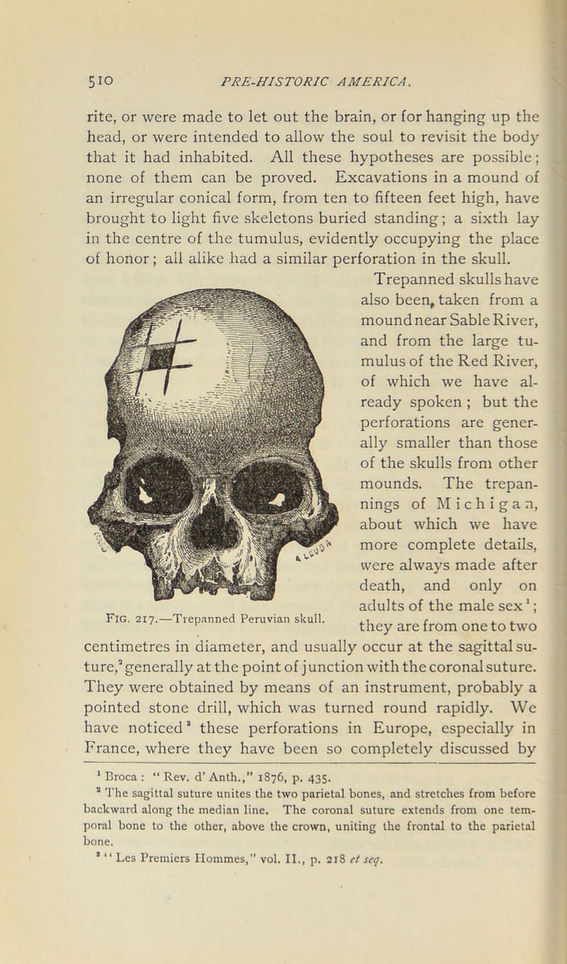 rite, or were made to let out the brain, or for hanging up the head, or were intended to allow the soul to revisit the body that it had inhabited. All these hypotheses are possible; none of them can be proved. Excavations in a mound of an irregular conical form, from ten to fifteen feet high, have brought to light five skeletons buried standing; a sixth lay in the centre of the tumulus, evidently occupying the place of honor; all alike had a similar perforation in the skull. Trepanned skulls have also been, taken from a mound near Sable River, and from the large tu- mulus of the Red River, of which we have al- ready spoken ; but the perforations are gener- ally smaller than those of the skulls from other mounds. The trepan- nings of Michigan, about which we have more complete details, were always made after death, and only on adults of the male sex1 2; they are from one to two centimetres in diameter, and usually occur at the sagittal su- ture,3 * * * generally at the point of junction with the coronal suture. They were obtained by means of an instrument, probably a pointed stone drill, which was turned round rapidly. We have noticed8 these perforations in Europe, especially in France, where they have been so completely discussed by 1 Broca : “ Rev. d’ Anth., 1876, p. 435. 2 The sagittal suture unites the two parietal bones, and stretches from before backward along the median line. The coronal suture extends from one tem- poral bone to the other, above the crown, uniting the frontal to the parietal bone. 8 “ Les Premiers Ilommes,” vol. II., p. 21S et seq. Fig. 217.—Trepanned Peruvian skull.