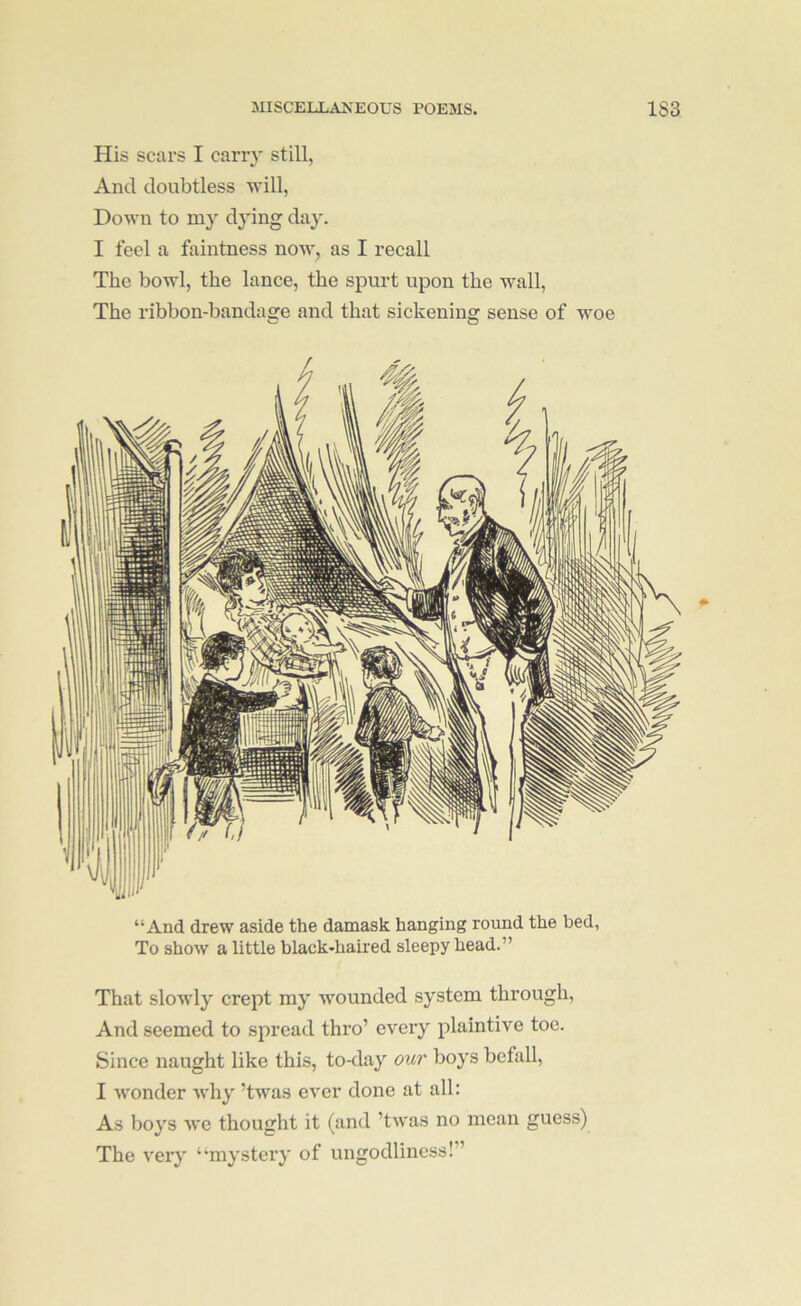 His scars I cany still, And doubtless will, Down to my dying day. I feel a faintness now, as I recall The bowl, the lance, the spurt upon the wall. The ribbon-bandage and that sickening sense of woe “And drew aside the damask hanging round the bed, To show a little black-haired sleepy head.” That slowly crept my wounded system through, And seemed to spread thro’ every plaintive toe. Since naught like this, to-day our boys befall, I w'onder why ’twas ever done at all: As boys we thought it (and ’twas no mean guess) The very ‘mystery of ungodliness!”