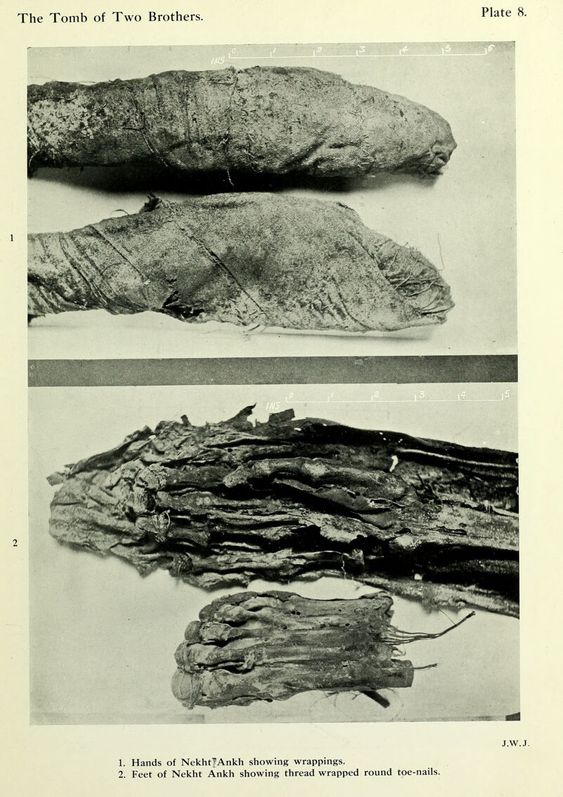 J.W.J. 1. Hands of NekhtfAnkh showing wrappings. 2. Feet of Nekht Ankh showing thread wrapped round toe-nails.