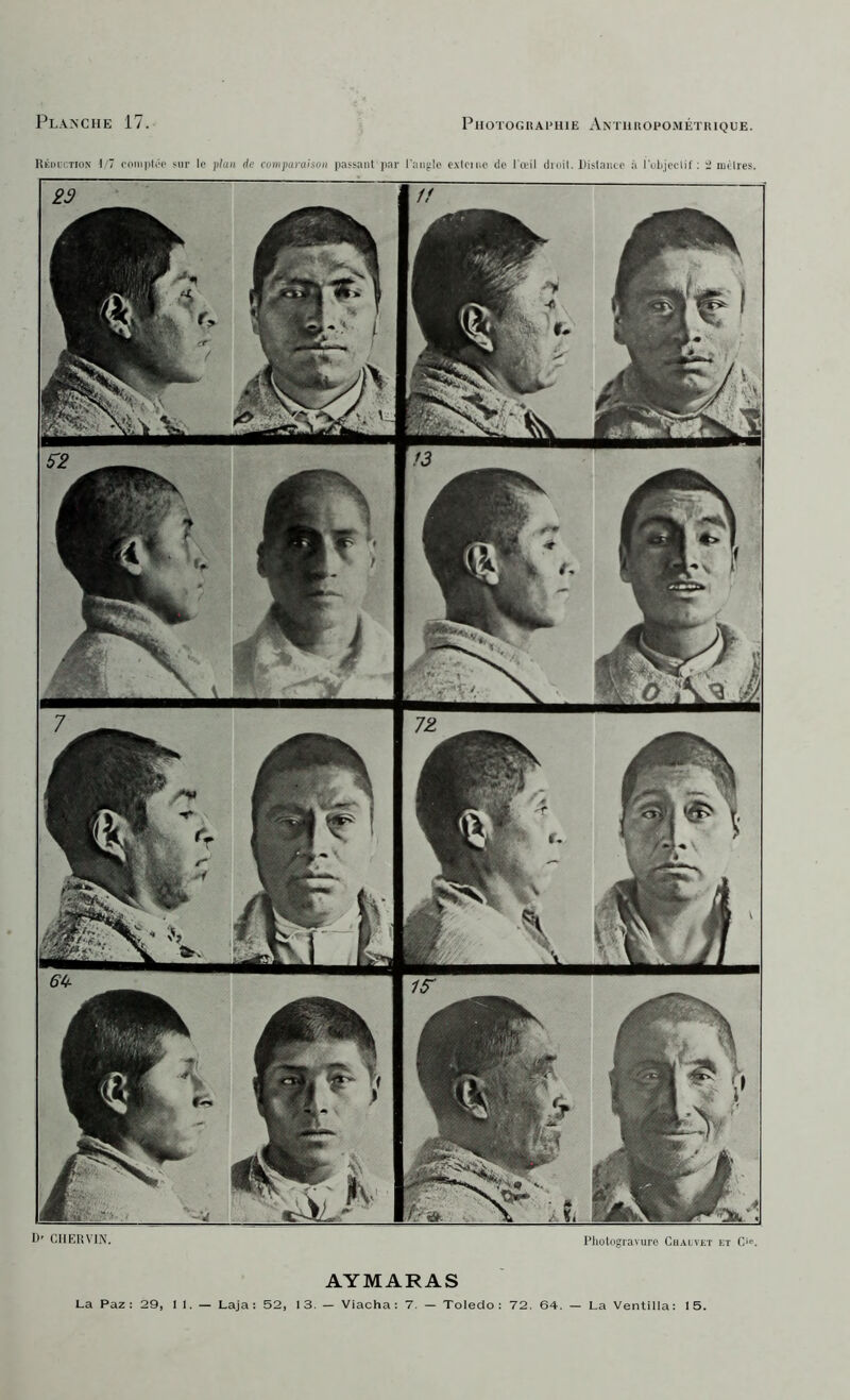 Pl.oxhe 17. PlIOTOGHAl>lU£ Am'IIUOPO.MÉTUIQUE. Rki)ii:tion I 7 cniiiiili'O ?m- le jilan do ooiiijun-aisoii passant jiar l'aiijile cxleinc de l'œil dmil. Distaiiio à l'ulijcelil'; ri niilres. D' CllERVIN, Photogravure Ciialvet et C' AYMARAS