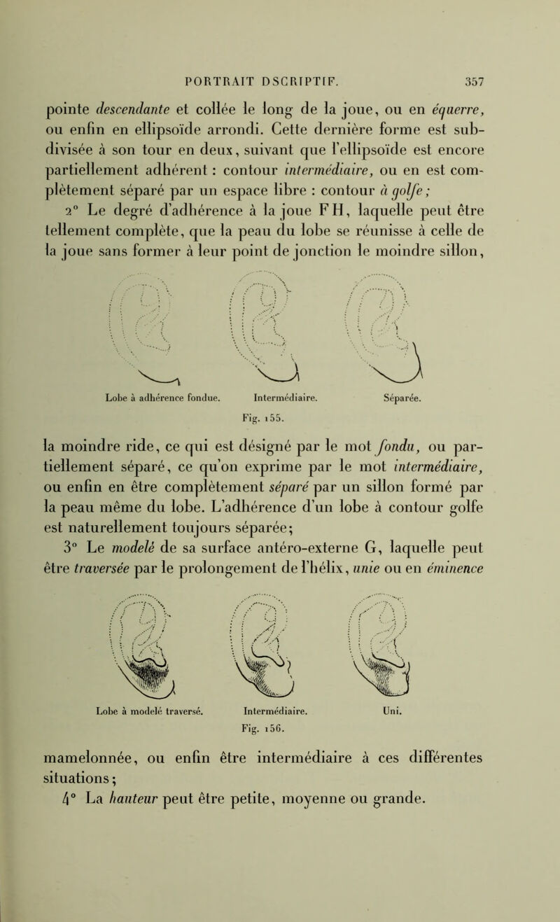 pointe descendante et collée le long- de la joue, ou en écjaerre, ou enfin en ellipsoïde arrondi. Cette dernière forme est sub- divisée à son tour en deux, suivant cjue l’ellipsoïde est encore partiellement adhérent : contour intermédiaire, ou en est com- plètement séparé par un espace libre : contour à golfe ; 2 Le degré d’adbérence à la joue F H, laquelle peut être tellement complète, que la peau du lobe se réunisse à celle de la joue sans former à leur point de jonction le moindre sillon. i (■ ■ ■ i Lobe à adhérence fondue. la moindre ride, ce qui est désigné par le mot fondu, ou par- tiellement séparé, ce qu’on exprime par le mot intermédiaire, ou enfin en être complètement séparé par un sillon formé par la peau même du lobe. L’adhérence d’un lobe à contour golfe est naturellement toujours séparée; 3“ Le modelé de sa surface antéro-externe G, laquelle peut être traversée par le prolongement de l’hélix, unie ou en éminence Lobe à modelé traversé. Fig. i56. mamelonnée, ou enfin être intermédiaire à ces différentes situations ; 4 La hauteur peut être petite, moyenne ou grande.