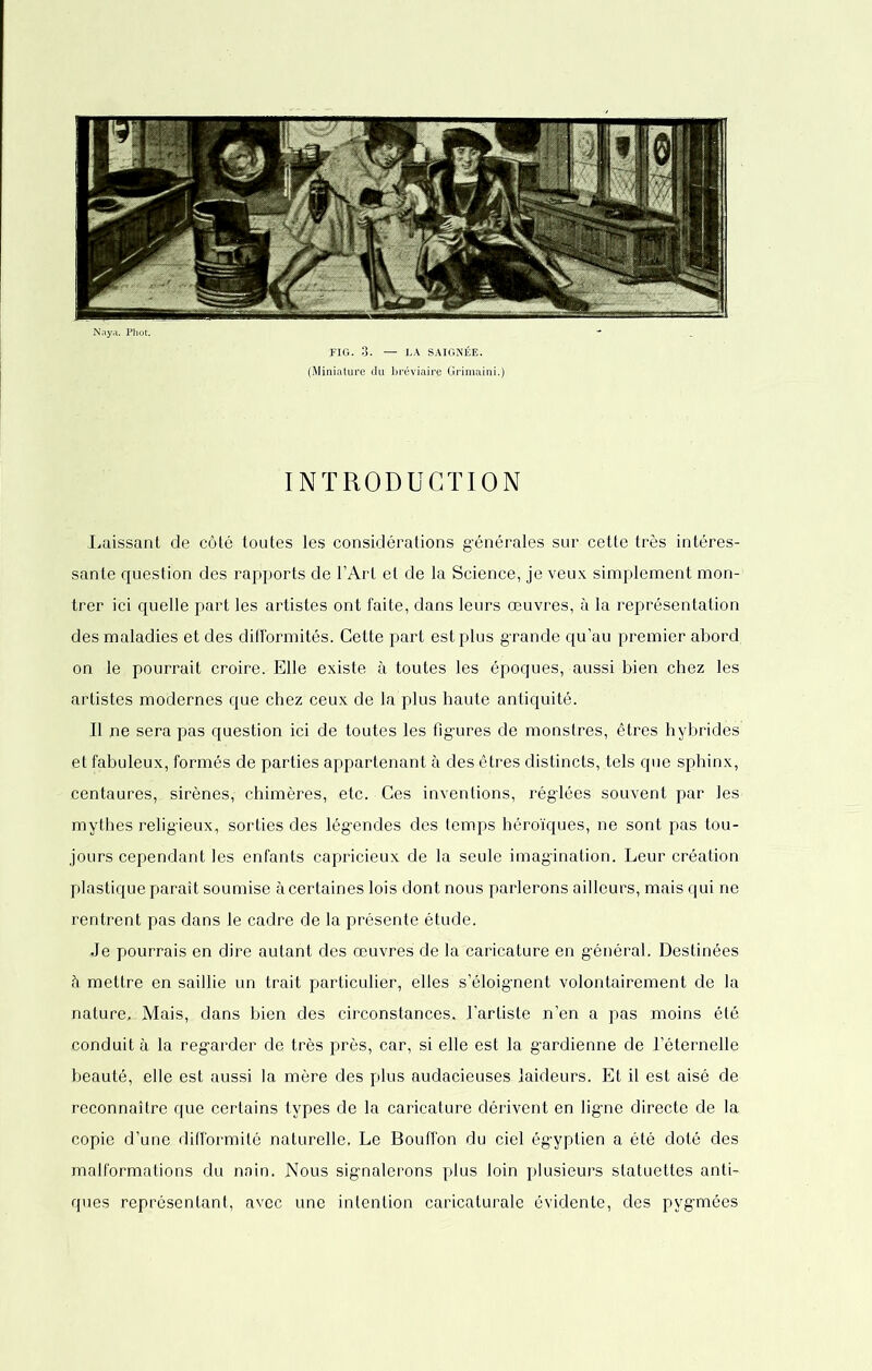 FIG. 3. — LA SAIGNÉE. (Miniature du bréviaire Grimaini.) INTRODUCTION Laissant de côté toutes les considérations générales sur cette très intéres- sante question des rapports de l’Art et de la Science, je veux simplement mon- trer ici quelle part les artistes ont faite, dans leurs œuvres, à la représentation des maladies et des difformités. Cette part est plus grande qu’au premier abord, on le pourrait croire. Elle existe à toutes les époques, aussi bien chez les artistes modernes que chez ceux de la plus haute antiquité. Il ne sera pas question ici de toutes les figures de monstres, êtres hybrides' et fabuleux, formés de parties appartenant à des êtres distincts, tels que sphinx, centaures, sirènes, chimères, etc. Ces inventions, réglées souvent par les mythes religieux, sorties des légendes des temps héroïques, ne sont pas tou- jours cependant les enfants capricieux de la seule imagination. Leur création plastique paraît soumise à certaines lois dont nous parlerons ailleurs, mais qui ne rentrent pas dans le cadre de la présente étude. Je pourrais en dire autant des œuvres de la caricature en général. Destinées à mettre en saillie un trait particulier, elles s’éloignent volontairement de la nature..Mais, dans bien des circonstances, l’artiste n’en a pas moins été conduit à la regarder de très près, car, si elle est la gardienne de l’éternelle beauté, elle est aussi la mère des plus audacieuses laideurs. Et il est aisé de reconnaître que certains types de la caricature dérivent en ligne directe de la copie d’une difformité naturelle. Le Bouffon du ciel égyptien a été doté des malformations du noin. Nous signalerons plus loin plusieurs statuettes anti- ques représentant, avec une intention caricaturale évidente, des pygmées