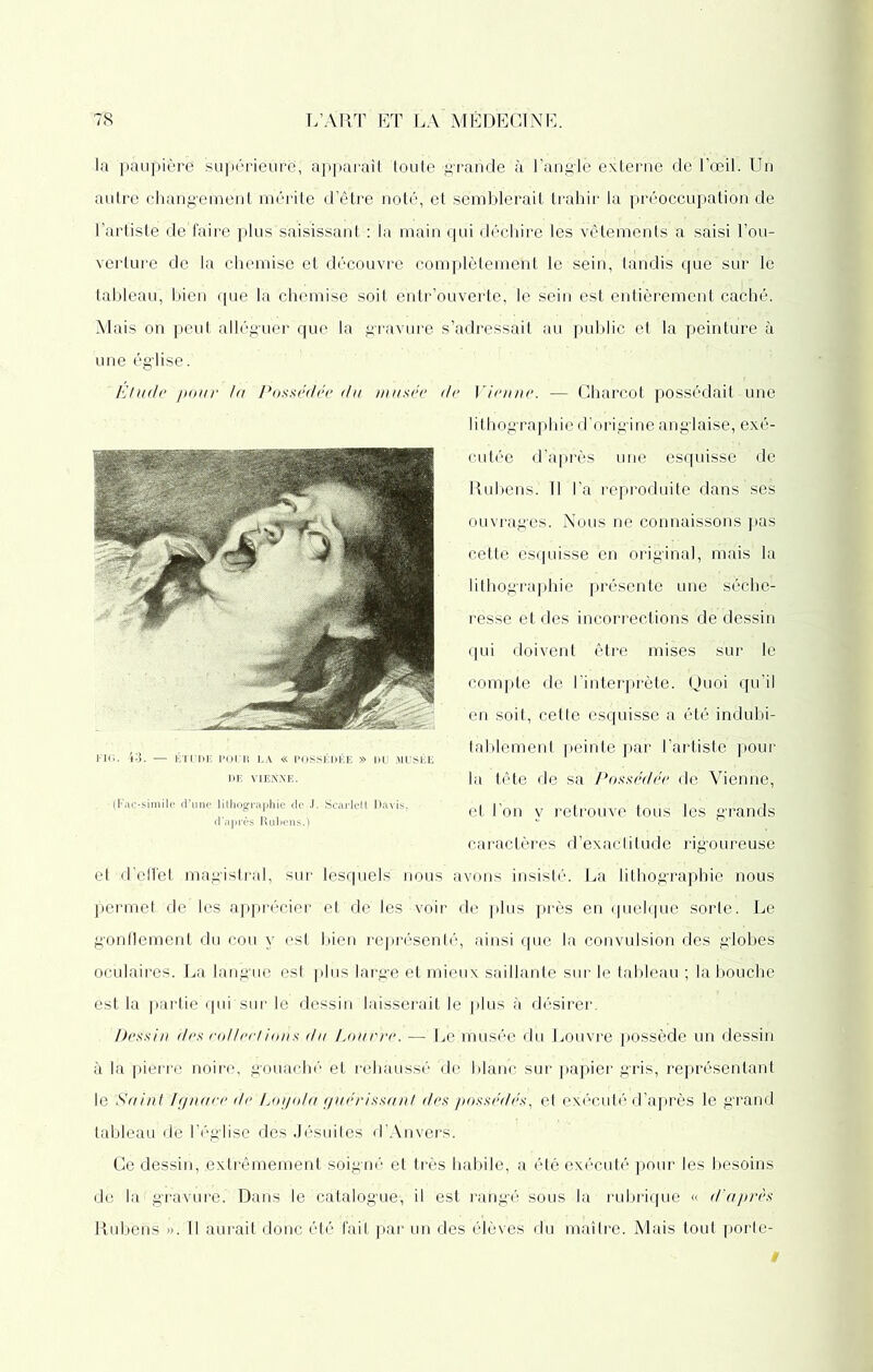 la paupière supérieure, apparaît toute -grande à l’angië externe de l’œil. Un autre changement mérite d’être noté, et semblerait trahir la préoccupation de l’artiste dé faire plus saisissant : la main qui déchire les vêtements a saisi l’ou- verture de la chemise et découvre complètement le sein, tandis que'sur le tableau, bien que la chemise soit entr’ouverte, le sein est entièrement caché. Mais on peut alléguer que la gravure s’adressait au public et la peinture à une église. Etude pour la Possédée du musée de FIG. 4*3. — ÉTUDE POUR LA « POSSÉDÉE » DU MUSÉE DE VIENNE. (Fac-similé d’une lithographie de J.-Scarlett Davis, d’après Rubens.) Vienne. — Charcot possédait une lithographie d’origine anglaise, exé- cutée d’après une esquisse de Rubens. Il l’a reproduite dans ses ouvrages. Nous ne connaissons pas cette esquisse en original, mais la lithographie présente une séche- resse et des incorrections de dessin qui doivent être mises sur le compte de l’interprète. Quoi qu’il en soit, cette esquisse a été indubi- tablement peinte par l’artiste pour la tête de sa Possédée de Vienne, et l’on y retrouve tous les g’rands caractères d’exactitude rigoureuse et d’elfet magistral, sur lesquels' nous avons insisté. La lithographie nous permet de les apprécier ;et de les voir de plus près en quelque sorte. Le gonflement du cou y est bien représenté, ainsi que la convulsion des globes oculaires. La langue est plus large et mieux saillante sur le tableau ; la bouche est la partie qui sur le dessin laisserait le plus à désirër. Dessin des collections du Louvre. — Le musée du Louvre possède un dessin à la pierre noire, gouache et rehaussé de blanc sur papier gris, représentant le Saint Ignace de Loyola guérissant des possédés, et exécuté d’après le g’rand tableau de l’église des Jésuites d’Anvers. Ce dessin, .extrêmement soigné et très habile, a été exécuté pour les besoins de la gravure. Dans le catalogue-, il est rangé sous la rubrique « d’après Rubens ». Il aurait donc été fait par un des élèves du maître. Mais tout porte-