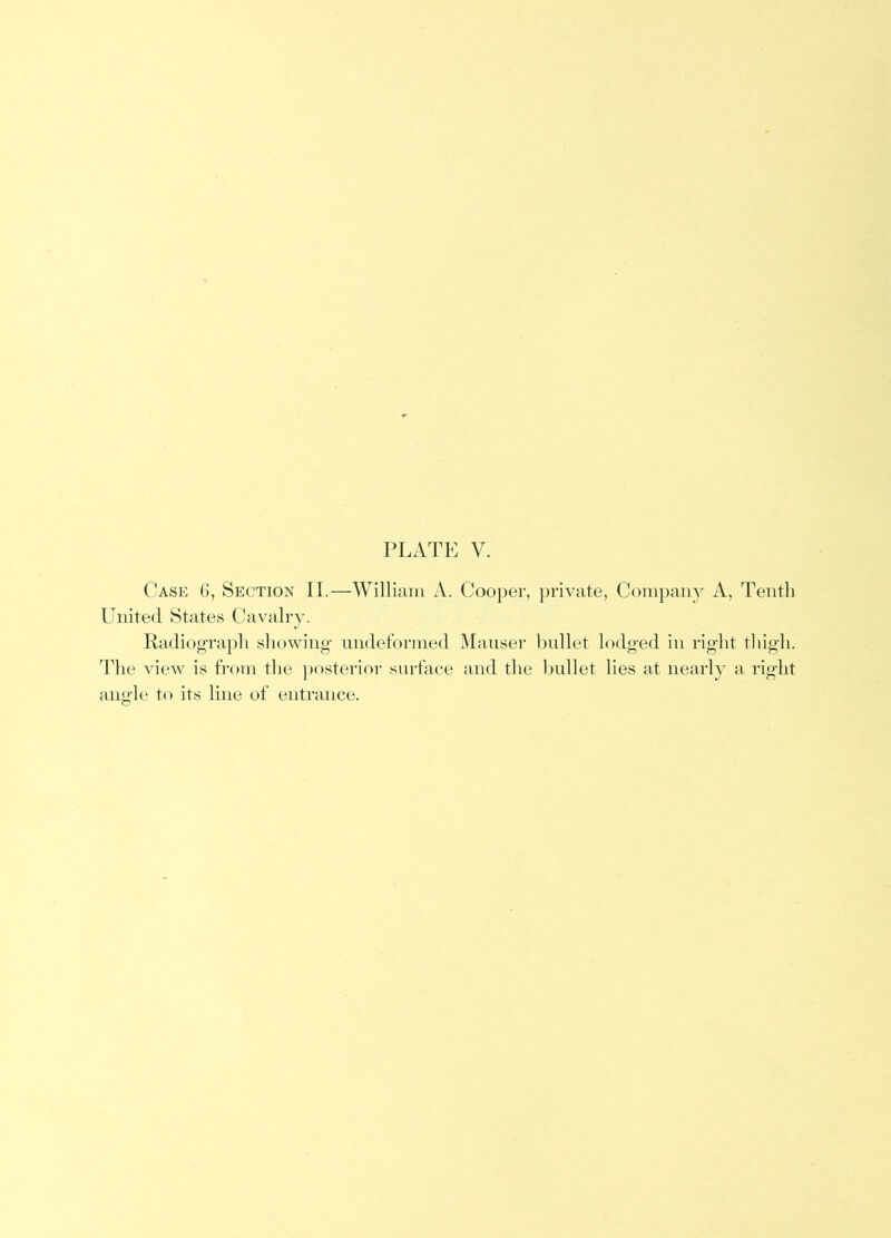 Case 6, Section II.—William A. Cooiier, private, Company A, Tenth United States Cavalry. Radiog-raph showing- undeformed Manser bullet lodged in right tliigh. The view is fi-om the posterior siirface and the bullet lies at nearly a right angle to its line of entrance.