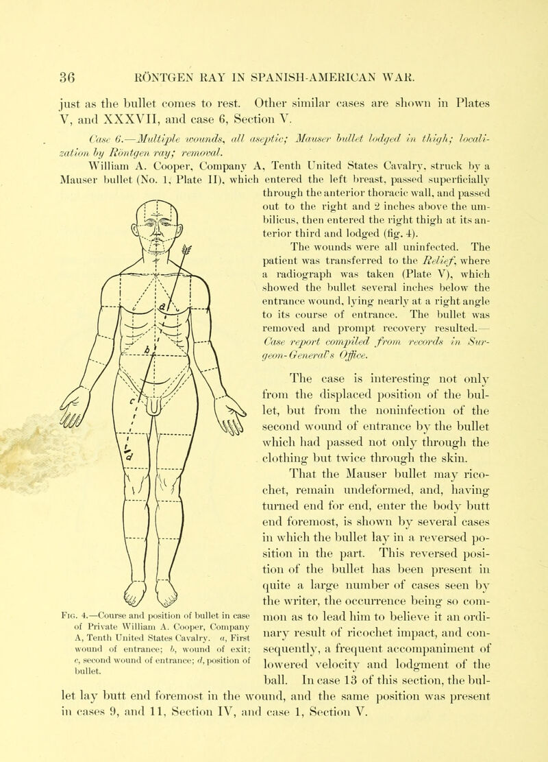 just as the bullet comes to rest. Other similar cases are shown in Plates V, and XXXVII, and case 6, Section V. Cat^e 0.—Multiple 'wounds^ all meptic; Mauser hullet lodged in thigh,' locali- zation l>y Rbntgen ray; removal. William A. Coopei’, Compain A, Tenth United States Cavalry, struck lyy a Mauser bullet (No. 1. Plate II). which entered the left breast, pas-sed superticially through the anterior thoracic wall, and passed out to the right and 2 inches above the um- bilicus, then entered the right thigh at its an- terior third and lodged (tig. -I). The wounds were all uninfected. The patient was transferred to the Relief, where a radiograph was taken (Plate V), which showed the bullet several inches below the entrance wound, lying nearly at a right angle to its course of entrance. The bullet w'as removed and prompt recovery resulted.— Case report comgnled from records in Sur- geon-GeneraVs Office. The case is interesting- not only from the displaced position of the bul- let, but from the noninfection of the second wound of entrance by the bullet which had passed not only through the clothing but twice through the skin. That the Mauser bullet may rico- chet, remain undeformed, and, having turned end for end, enter the body butt end foremost, is shown by several cases in which the bullet lay in a reversed })o- sition in the part. This reversed posi- tion of the bullet has been present in quite a large number of cases seen by the writer, the occurrence being so com- mon as to lead him to believe it an ordi- nary result of ricochet impact, and con- sequently, a fre(]uent accompaniment of lowered velocity and lodgment of the ball. In case 13 of tliis section, the I)ul- let lay butt end foremost in the wound, and the same position was present in cases 9, and 11, Section IV, and case 1, Section V. Fig. 4.—Course and position of bullet in case of Private William A. Cooper, Company A, Tenth United States Cavalry. «, First wound of entrance; h, wound of exit; c, second wound of entrance; </, position of bullet.