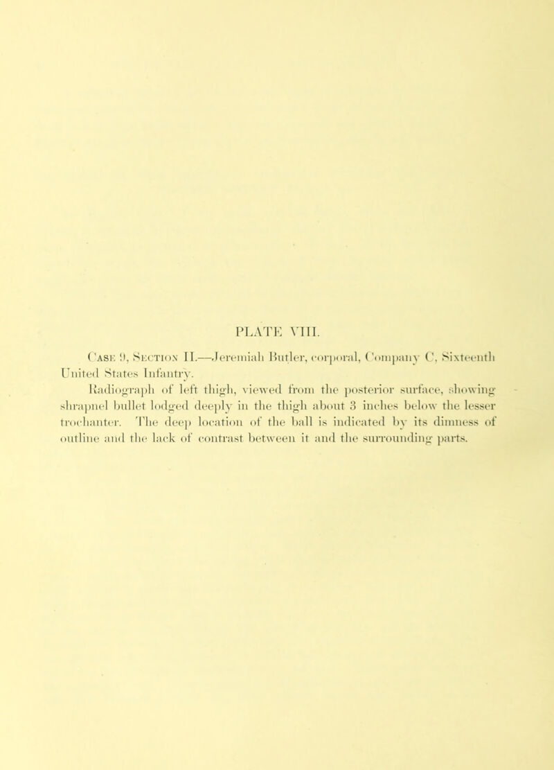 Cask i). Section II.—Jeivniiah Hutler, corporal, Conipany C, Sixtcciitli Cnited States Infantry. Uadioo-rapli of left tlil«li, viewed from the jio.sterior surface, sliowinji' shrapnel hnllet Indeed deejily in the thij^h about 3 inches below the lesser trochantca-. 'I’lie dee]) location of the ball is indicated by its dimness of outline and tiu* lack of contrast between it and the surroundine- jiarts.