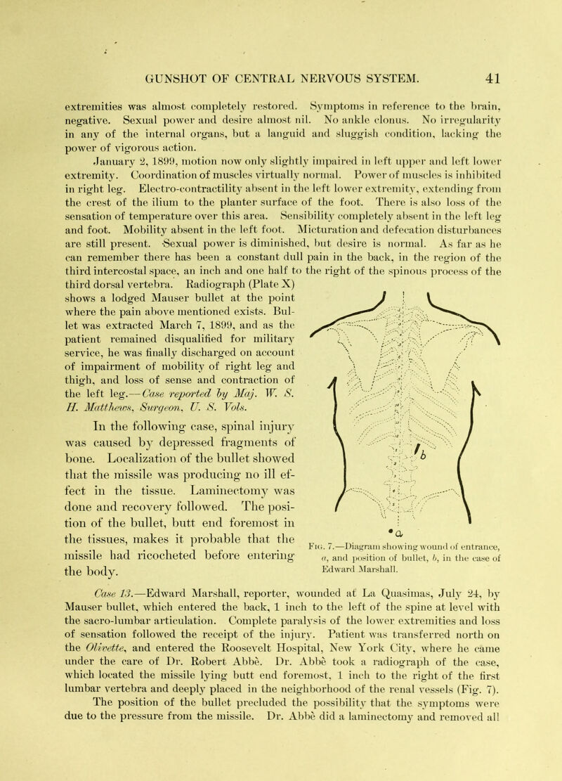 extremities was almost completely restored. Symptoms in reference to the brain, negative. Sexual power and desire almost nil. No ankle clonus. No irregularity in any of the internal organs, but a languid and sluggish condition, lacking the power of vigorous action. .January 2, 1899, motion now only slightly impaired in left upper and left lower extremity. Coordination of muscles virtually normal. Power of muscles is inhibit('(l in right leg. Electro-contractility absent in the left lower extremity, extending from the crest of the ilium to the planter surface of the foot. There is also loss of the sensation of temperature over this area. Sensibility completely absent in the left leg and foot. Mobility absent in the left foot. Micturation and defecation disturbances are still present. -Sexual power is diminished, but desire is normal. As far as he can remember there has been a constant dull pain in the back, in the region of the third intercostal space, an inch and one half to the right of the spinous process of the third dorsal vertebra. Radiograph (Plate X) shows a lodged Mauser bullet at the point where the pain al)ove mentioned exists. Bul- let was extracted March 7, 1899, and as the patient remained disqualified for military service, he was finally discharged on account of impairment of mobility of right leg and thigh, and loss of sense and contraction of the left leg.—Case reported hy May. W. S. H. Surgeon., U. S. Voh. In the following case, spinal injury was caused b} depressed fragments of bone. Localization of the bullet showed that the missile was producing no ill ef- fect in the tissue. Laminectomy was done and recovery followed. The posi- tion of the bullet, butt end foremost in the tissues, makes it probable that the missile had ricocheted before entering the body. Fu;. 7.—Diafiraiii i.ho\viiig wound of entrance, «, and position of bullet, h, in the ca.se of Edward ^lanshall. Case 13.—Edward Marshall, reporter, wounded at La Quasimas, JuL hy Mauser bullet, which entered the back, 1 inch to the left of the spine at level with the sacro-lumbar articulation. Complete paralysis of the lower extremities and loss of sensation followed the receipt of the injury. Patient was transferred north on the Olivette., and entered the Roosevelt Hospital, New York City, where he came under the care of Dr. Robert Abbe. Dr. Abbe took a radiograph of the case, which located the missile lying butt end foremost, 1 inch to the right of the first lumbar vertebra and deeply placed in the neighborhood of the renal vessels (Fig. 7). The position of the bullet precluded the possibility that the symptoms were due to the pressure from the missile. Dr. Abbe did a laminectom3 and removed all