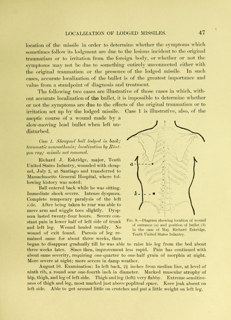 location of the missile in order to determine whether the symptoms which sometimes follow its lodgment are dne to the lesions incident to the ori<i’inal traumatism or to irritation from the forei<>n body, or whether or not the symptoms may not be due to something' entirely unconnected either with tlie original traumatism or the ])resence of the lodged missile. In such cases, accurate localization of the bullet is ot the greatest importance and value from a standpoint of diagnosis and treatment. The following two cases are illustrative of those cases in which, with- out accurate localization of the bullet, it is impossible to determine whether or not the symptoms are due to the effects of the original traumatism or to irritation set up by the lodged missile, aseptic course of a wound made by a slow-moving lead bullet when left un- disturbed. Case 1 is illustrative, also, of the Case 1. Shrapnel hall lodged in hack; traumatic neurustheina,' localization hy Ronf- gen ray; missile not removed. Richard J. Eski'idgc, major, Tenth United States Infantry, wounded with shrap- nel, July 2, at Santiago and transferred to Massachusetts General Hospital, where fol- lowing history was noted: Ball entered hack while he was sitting. Immediate shock severe. Intense dyspnma. Complete temporary paralysis of the left side. After being taken to rear was able to move arm and wiggle toes slightly. Dysp- nma lasted twenty-four hours. Severe con- stant pain in lower half of left side of trunk and left leg. Wound healed readily. No wound of exit found. Paresis of leg re- mained same for about three weeks, then began to disappear gradually till he was able to raise his leg from the bed about three weeks later. Since then, improvement less rapid. Pain has continued with about same severity, requiring one-quarter to one-half grain of morphia at night. More severe at night; more severe in damp weather. August 16. Examination: In left back, inches from median line, at level of ninth rib, a round scar one-fourth inch in diameter. Marked muscular atrophy of hip, thigh, and leg of left side. Thigh and leg (left) very flabby. Extreme sensitive- ness of thigh and leg, most marked just above popliteal space. Knee jeak ab.sent on left side. Able to get around little on crutches and put a little weight on left leg. Fig. 9.—Diafirain showinji location of wound of entrance (a) and jiosition of bullet (/;) in the case of Maj. Richard Eskridge, Tenth United States Infantry.