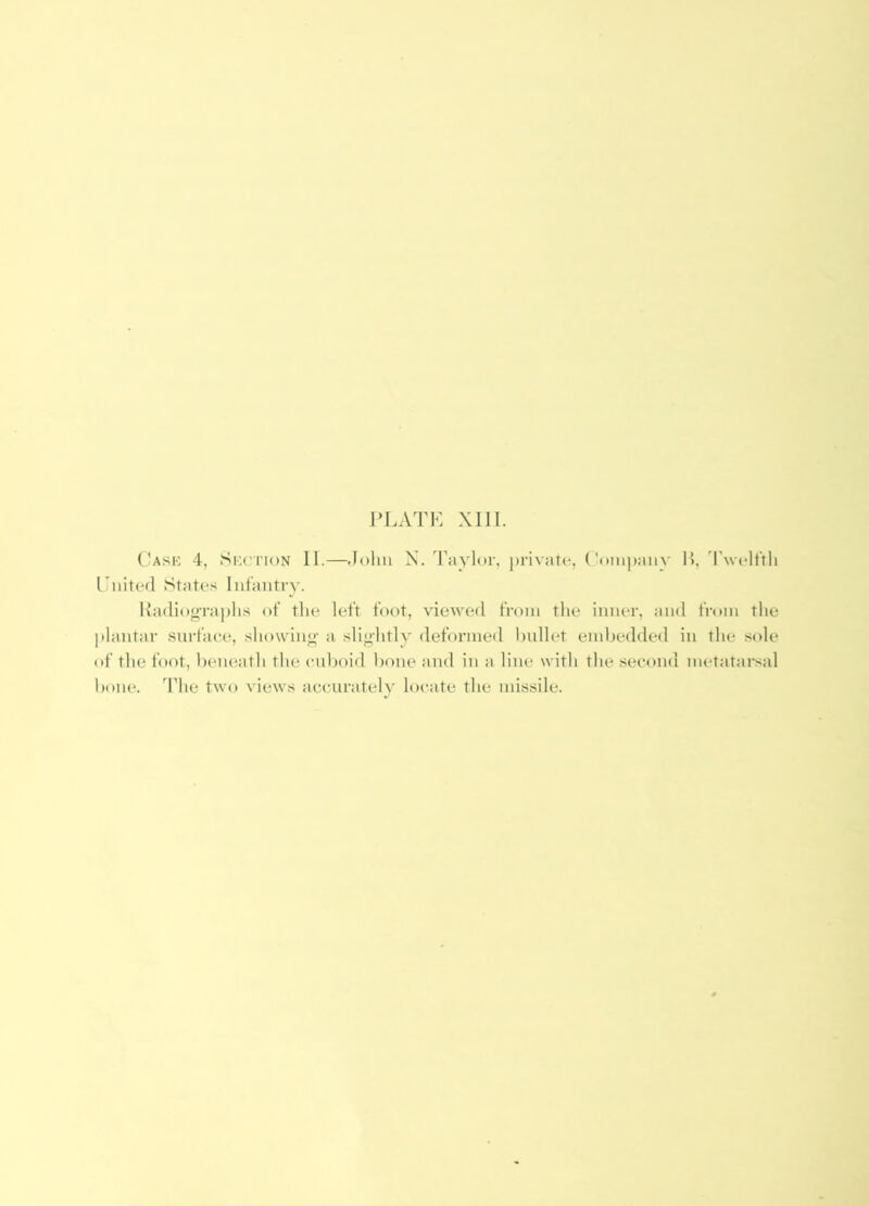 Cask 4, Skci'ion II.—John X. Taylor, j)rivate, ('onipaii}' l>, Twolt'tli Ciiited States Iiit’autry. Kadiog’raphs of tlie left foot, viewed from the inner, and from the plantar surface, showin<»’ a slightly deformed hnllet embedded in the sole of the foot, beneath the enboid bone and in a line with the second metatarsal bone. The two views accurately locate the missile.