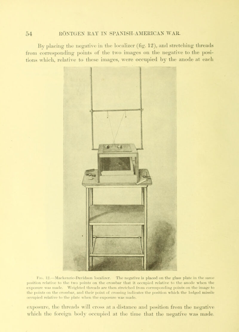 By j)l}U-iii{^ tlie neg-ative in tlu* localizer (fig. 12), and stretching threads t'roin corresponding ])oints of the two images (ni the negative to the }>osi- tions which, relative to these images, were occupied by the anode at each Ki<i. 12.—Mackenz'u'-Davidson loailizor. The nejnitive i.s place<l on the plate in the .■^iiine position relative to the two points on the erosshar that it oeeu|)ied relative to the anode when the exposure was made. Weighted threads are then stretclied from corres]>ondinjt points on the iniaj^' to tlm points on the erosshar, and thi“ir point of erossiiu; indicates the position whii'h the lod^iiHl missile occnpiiMl relative to the plate when the exposure was made. exposure, the threads will cross at ;i distance and position from the negative which the foreign body occupied ;it the time that the negative w;is nmde.