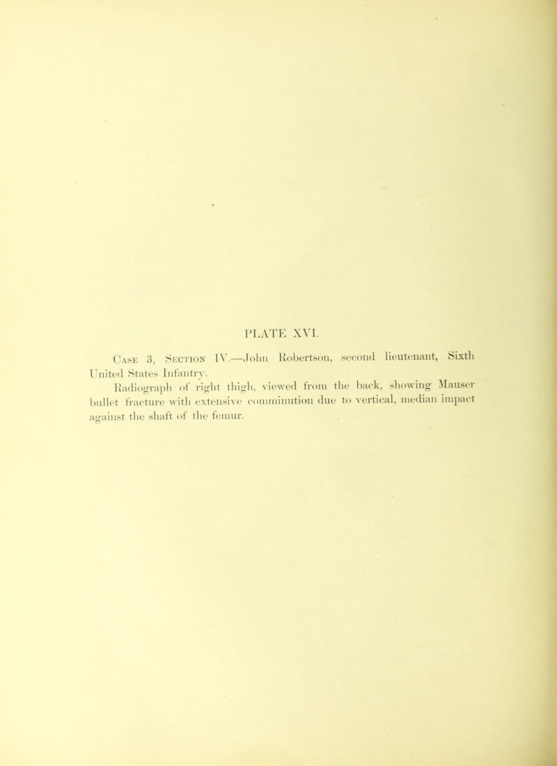 Case 3, Seci ion 1\ .—-Jolin Holjertsoii, second lieutenant, JSixtli Tinted States Infantry. l{adi()<»Ta])li of rio-Jit tliijih, viewed from the hack, .sliowingf Manser hullet fractni-e with extensive comniinution due to vertical, median imjiact amdiist the shaft of the femur.