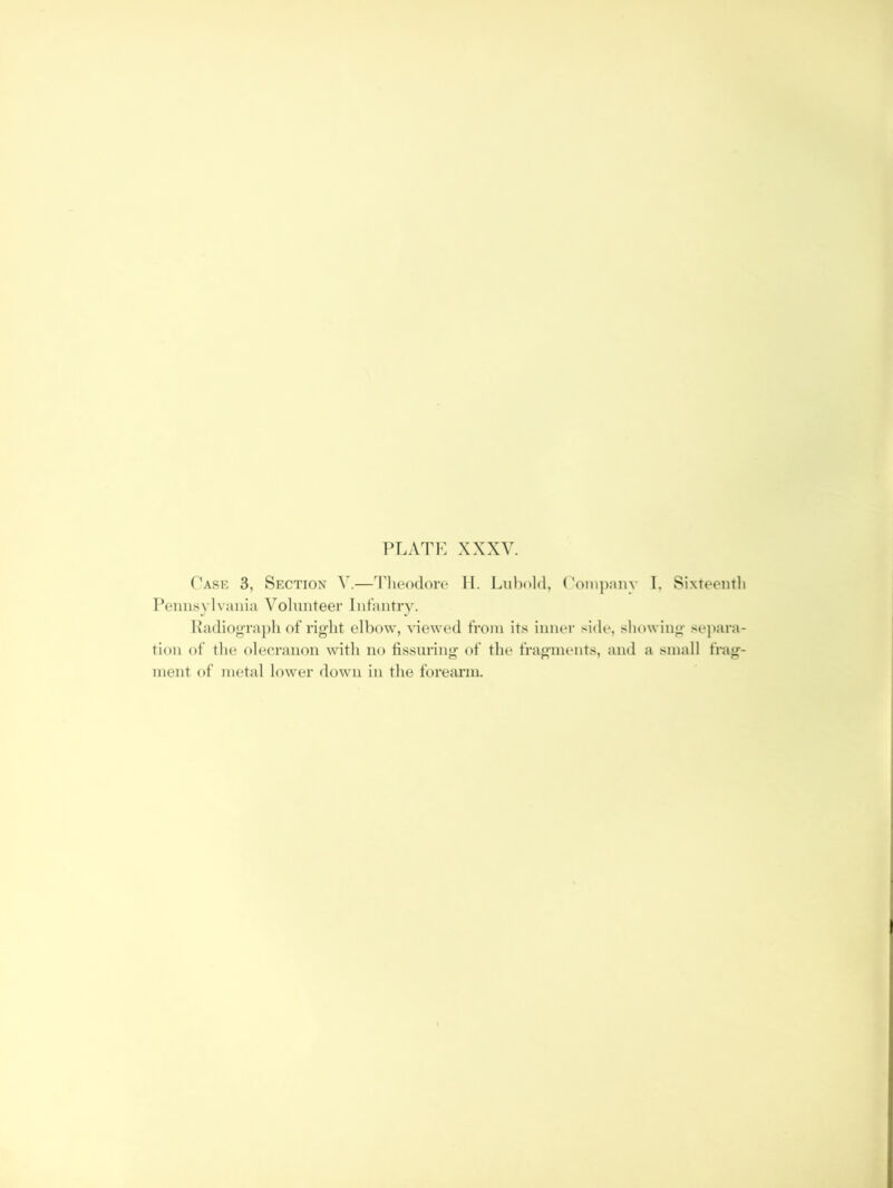 Task 3, Section V.—Tlieodoro II. Liibold, (’oinjiam- 1, Sixteentli I’eimsylvaiiia Volunteer liitantry. KadiogTapli of right elbow, viewed from its inner side, showing se]>ara- tion of the olecranon with no tissuring of the fragments, and a small frag- ment of metal lower down in the forearm.