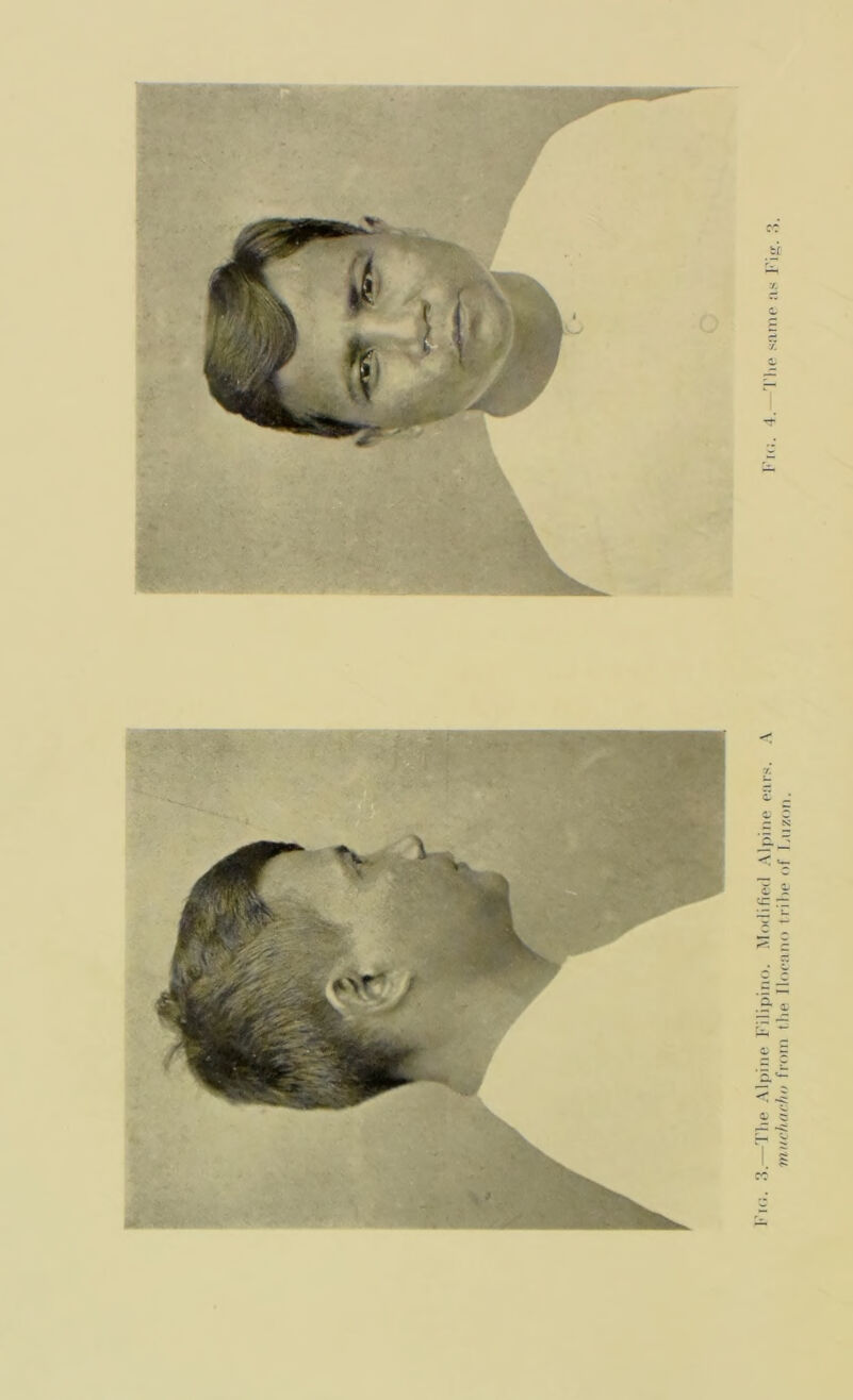 Tlie Alpine Filipino. Modifier! Alpine ears. A Fig. 4.—The same as Fi<r muchacht) from the Ilocano tribe of Luzon.