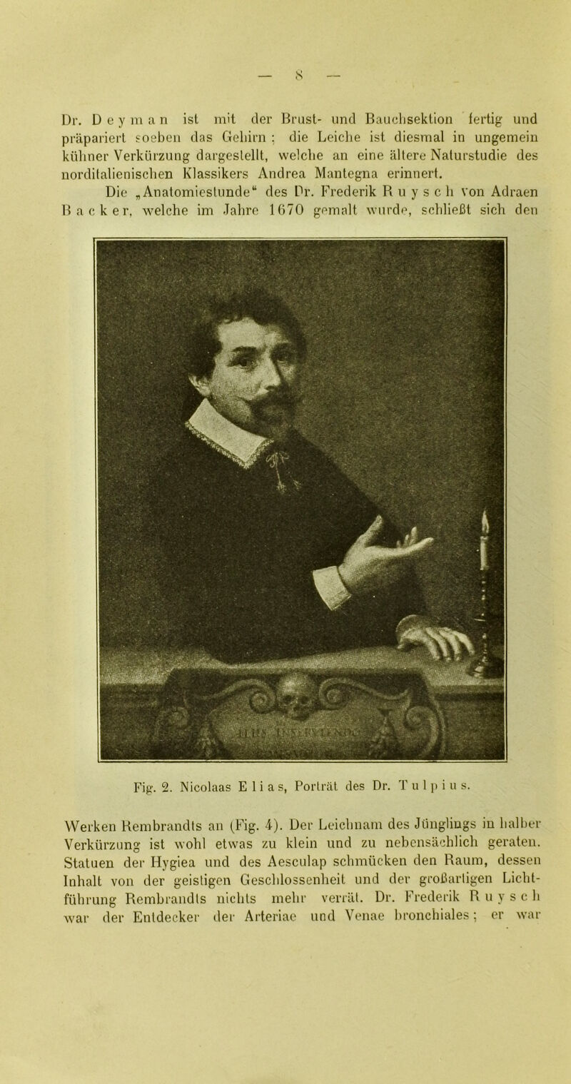 s Dr. D e y ni ;i n isl mit der Brasl- iind Baiiclisektion fertig und praparierl foebeii das CTeliiin ; die Leiclie ist diesmal in ungemein kiUiner Verkiiizung dargeslellt, welclie an eine allere Nalurstudie des norditalienischen Klassikers Andrea Mantegna erinnert. Die , Anatomiestimde“ des Dr. Frederik R u y s c li von Adraen Backer, welche im Jalire 1670 gemnlt wnrde, sclilieBt sich den Fig. 2. Nicolaas Elias, Porlriil des Dr. T u 1 p i u s. VVerken Rembrandts an (Fig. 4). Der Leicbnain des Jilngliugs in balber Verkiirzung ist wold etwas zu klein und zu nebensiicldich gerateu. Statuen der Hygiea und des Aesculap scbmiicken den Raum, dessen Inhalt von der geisligen Gescblossenheit und der groBarligen Licht- fubrung Rembrandts nichts melii' verriit. Dr. Frederik R u y s c li 'war der Enldecker der Arteriae und Venae l)ronchiales; er war