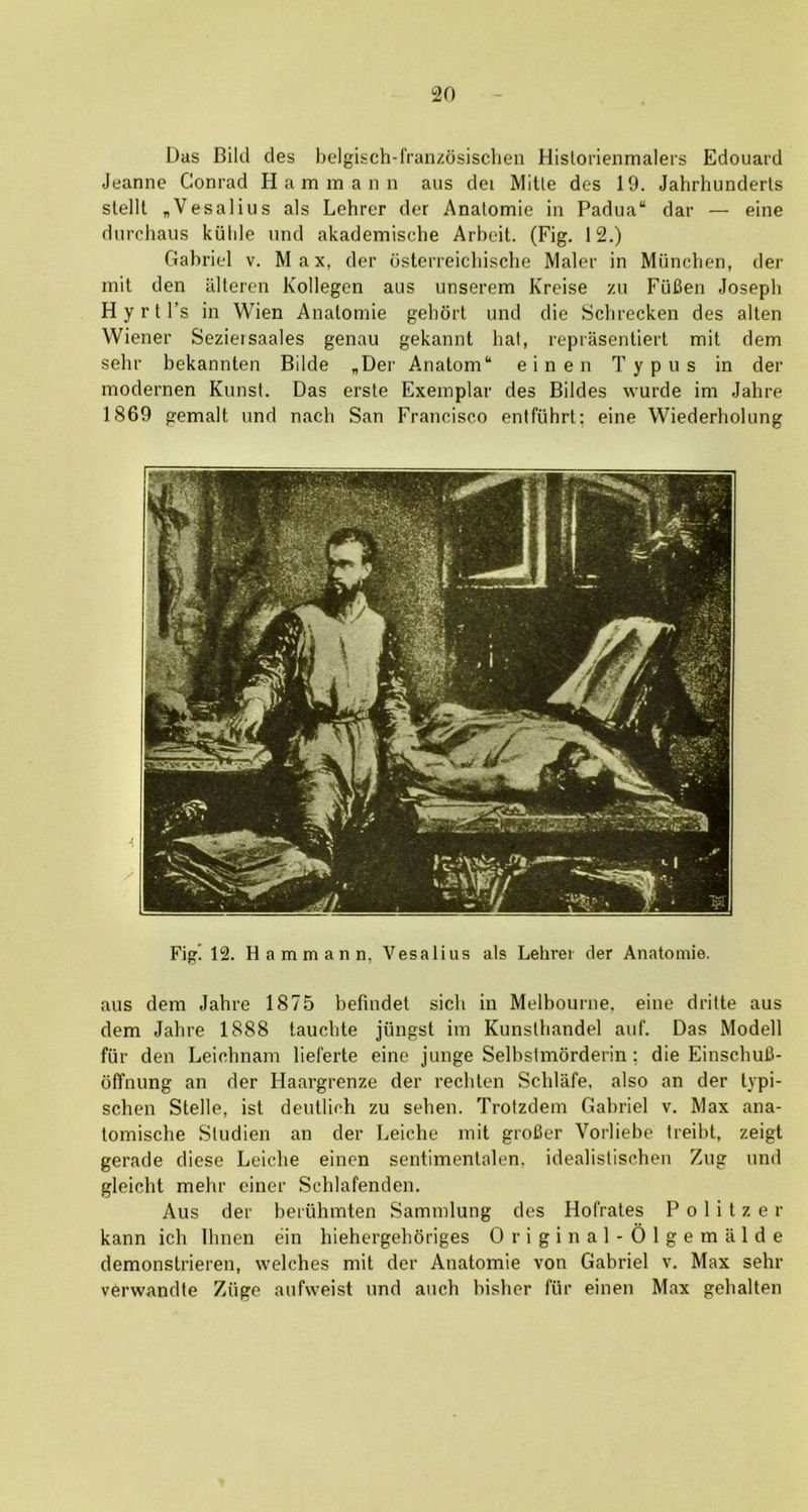 Das Bild des belgisch-f'ranzosischen Historienmalers Edouard Jeanne Conrad Hamm an n aus dei Mitle des 19. Jahrhunderts slellt „Vesalius als Lehrer der Anatomic in Padua“ dar — eine durcliaus kiilile und akademische Arbeit. (Fig. 12.) Gabriel v. Max, der dsterreicbische Maler in Miincben, der mit den alteren Kollegen aus unserem Kreise zu FilBen Joseph H y r t I’s in Wien Anatomic gebort und die Scbrecken des alten Wiener Seziersaales genau gekannt hal, reprasentiert mit dem sehr bekannten Bilde „Der Anatom“ einen Typus in der modernen Kunst. Das erste Exemplar des Bildes wurde im Jahre 1869 gemalt und nach San Francisco entfuhrt; eine Wiederholung Fig! 12. Hammann, Vesalius als Lehrer der Anatoinie. aus dem Jahre 1875 befmdet sicli in Melbourne, eine dritte aus dem Jahre 1888 taucbte jiingst im Kunstbandel auf. Das Modell fill- den Leichnam lieferte eine junge Selbstmorderin; die EinscbuC- offnung an der Flaargrenze der redden Schlafe, also an der typi- schen Stelle, ist deutlich zu selien. Trotzdem Gabriel v. Max ana- tomische Sludien an der Leicbe mit groBer Vorliebe treibt, zeigt gerade diese Leicbe einen sentimentalen, idealistischen Zug und gleicht mehr einer Schlafenden. Aus der beruhmten Sammlung des Hol'rates P o 1 i t z e r kann ich Ilmen ein hiehergehdriges Original-Olgemalde demonstrieren, welches mit der Anatomic von Gabriel v. Max sehr verwandte Ziige aufweist und auch bisher fiir einen Max gehalten