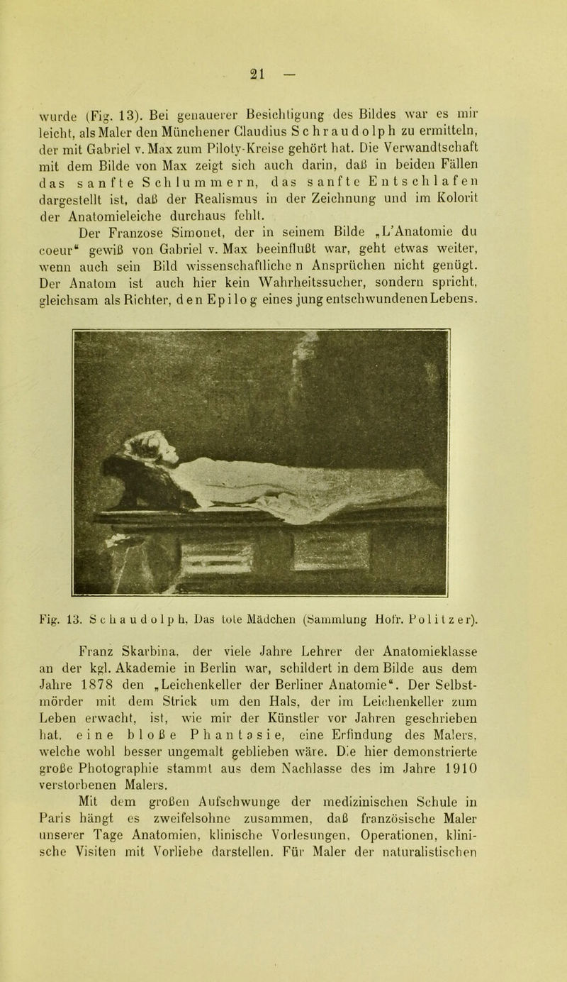 wiirde (Fig. 13). Bei geuauerer BesicliligLUig des Bildes war es iiiir leicht, alsMaler den Muncliener Claudius S c hr au d olp h zu ermilteln, der mil Gabriel v. Max zum Piloty-Kreise gehort hat. Die Verwandlschaft mit dem Bilde von Max zeigt sich auch darin, dab in beiden Fallen das sanfte Schlummern, das sanfte Entschlafen dargestellt ist, dab der Realismus in der Zeichnung und im Kolorit der Anatoinieleiche durchaus fehlt. Der Franzose Simonet, der in seinem Bilde „L’Anatomie du coeur* gewib von Gabriel v. Max beeinflubt war, geht etwas weiter, wenn auch sein Bild wissenschaftliche n Anspriichen nicht geniigt. Der Anatom ist auch hier keiu Wahrheitssucher, sondern spricht, gleichsam als Richter, den Epilog eines jungentschwundenenLebens. Fig. 13. S c li a u d u 1 jj h, Das lole Madchen (Sainmlung Hofr. P o I i I z e r). Franz Skarbina. der viele Jahre Lehrer der Anatomieklasse an der kgl. Akademie in Berlin war, schildert in dem Bilde aus dem Jahre 1878 den „ Leichenkeller der Berliner Anatomie“. Der Selbst- mdrder mit dem Strick um den Hals, der ira Leichenkeller zum Leben erwachf, ist, wie mir der Kiinstler vor Jahren geschrieben hat, eine blobe Phantasie, eine Erfmdung des Malers, welche wohl besser ungemalt geblieben ware. Die hier demonstrierte grobe Photographie stamml aus dem Nachlasse des im Jahre 1910 verslorbenen Malers. Mit dem groben Aufschwunge der medizinischen Schule in Paris hangt es zweifelsohne zusammen, dab franzosische Maler unserer Tage Anatomien, klinische Vorlesungen, Operationen, klini- sche Visiten mit Vorliebe darstellen. Fiir Maler der naturalistischen