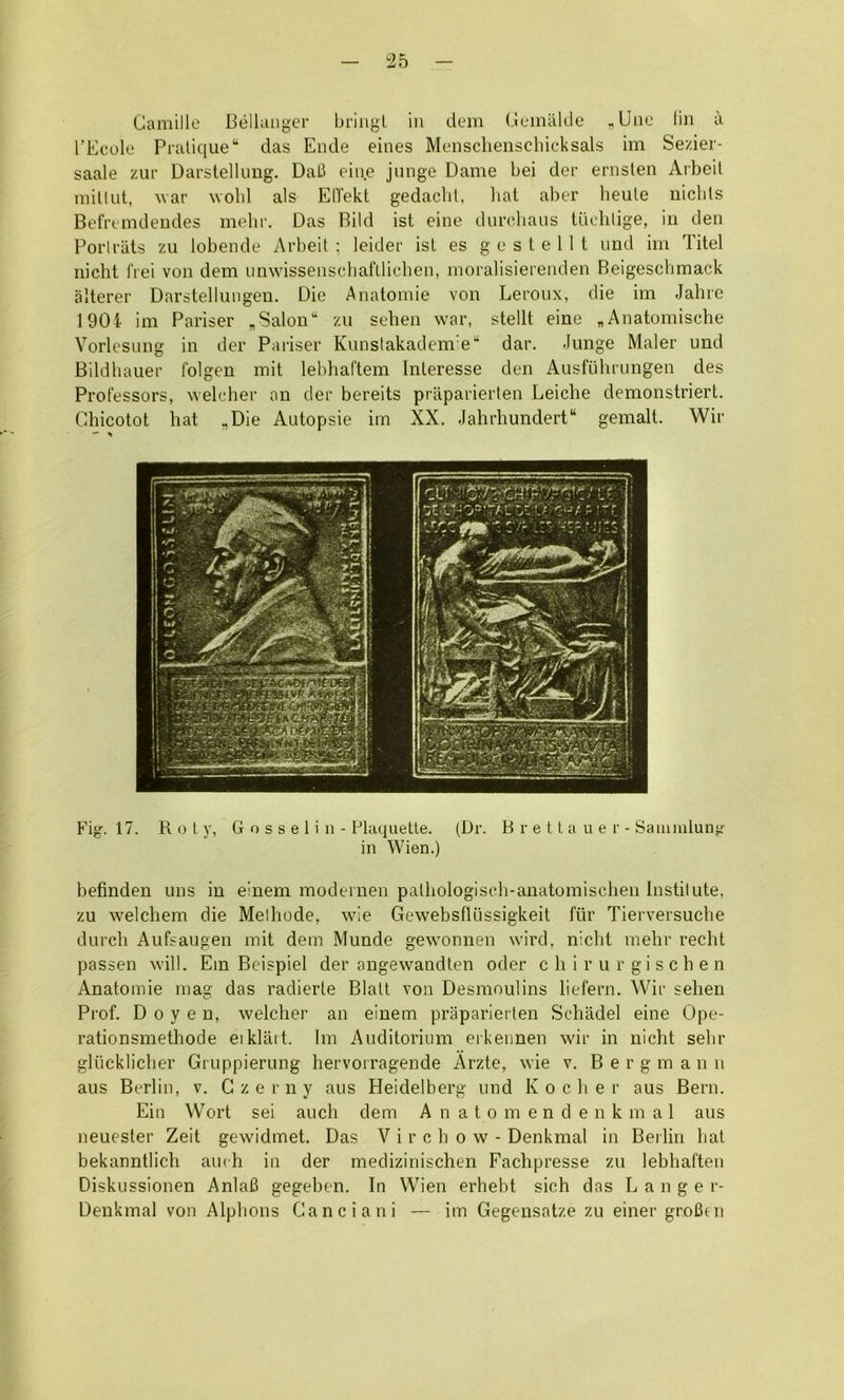 I'Ecole Pratique“ das Ende eines Menschenschicksals im Sezier- saale zur Darstellimg. DaB eine jiuige Dame bei der enislen Arbeit mitt lit, war wolil als EITekt gedacld, liat aber heute niclds Befremdeudes melir. Das Bild ist eine durchaus tnelilige, in den Porlriits zu lobende Arbeit ; leider ist es g e s t e 11 t und im Titel iiicht I'rei von dem unwissenscbafllielien, moralisierenden Beigeschmack alterer Darstellungen. Die Anatomie von Leroux, die im Jahrc 190i- im Pariser , Salon‘ zu sehen war, stellt eine „Anatomische Yorlesung in der Pariser Kimstakadem'e“ dar. Junge Maler und Bildbauer folgen mit lebliaftem Interesse den Ausfuhriingen des Professors, weleher an der bereits priiparierten Leiche demonstriert. Chicotot hat ,Die Autopsie im XX. Jahrhundert“ gemalt. Wir Fig. 17. R o t y, G o s s e 1 i n - Plaquetle. (Dr. B r e 11 a u e r - Saiiimlung in Wien.) befinden uns in einem modernen pathologlsch-anatomischen Institute, zu welcliem die Melhode, wie Gewebsflussigkeit fiir Tierversuche durch Aufsaugen mit dem Munde gewonnen wird, nicht mehr recht passen will. Em Beispiel der angewandten oder c h i r u r g i s c h e n Anatomie mag das radierte Blatt von Desmoulins liefern. Wir sehen Prof. Doyen, welcher an einem praparierten Schadel eine Ope- rationsmethode eiklait. Im Auditorium eikeiinen wir in nicht sehr gliicklicher Gruppierung hervorragende Arzte, wie v. Bergman n aus Berlin, v. Czerny aus Heidelberg und Kocher aus Bern. Ein Wort sei auch dem A n a t o m e n d e n k m a 1 aus neuester Zeit gewidmet. Das Virchow- Denkmal in Beilin hat bekanntlich aiuh in der medizinischen Fachpresse zu lebhaften Diskussionen AnlaB gegeben. In Wien erhebt sich das Danger- Denkmal von Alphons Canciani — im Gegensatze zu einer groBni
