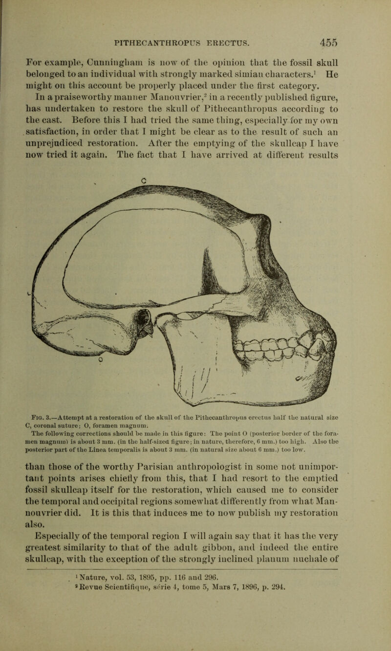 Fig. 3 Attempt at a restoratiou of the skull of the Pithecanthropus erectus half the natural size C, coronal suture; O, foramen magnum. The following corrections should he made in this figure: The point O (posterior border of the fora- men magnum) is about 3 mm. (in the half-sized figure; in nature, therefore, C mm.) too high. Also the posterior part of the Linea temiioralis is about 3 mm. (in natural size about G mm.) too low. than those of the worthy Parisiaii anthropologist in some not unimx^or- tant points arises chiefly from this, that I had resort to the emptied fossil skullcap itself for the restoratiou, which caused me to consider the temporal and occipital regions somewhat differently from what Man- uouvrier did. It is this that induces me to now publish my restoration also. Especially of the temporal region I will again say that it has the very greatest similarity to that of the adult gibbon, and indeed the entire skullcap, with the exception of the strongly inclined planum nuchale of 1 Nature, vol. 53, 1895, pp. 116 and 296. 3 Revue Scientifique, sf^rie 1, tome 5, Mars 7, 1896, p. 294. PITHECANTHROPUS ERECTUS. 455 For example, Cunningham is now of the opinion that the fossil skull belonged to an individual with strongly marked simian characters.^ He might on this account be properly placed under the first category. In a praiseworthy manner Manouvrier,^ in a recently published figure, has undertaken to restore the skull of Pithecanthropus accordiug to the cast. Before this I had tried the same thing, especially for my own .satisfaction, in order that I might be clear as to the result of such an unprejudiced restoration. After the emptying of the skullcap I have