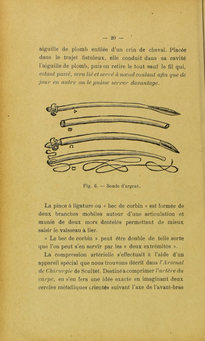 aiguille de plomb enfilée d’un crin de cheval. Placée dans le trajet fistuleux, elle conduit dans sa cavité l’aiguille de plomb, puis on retire le tout sauf le fil qui, estant passe, sera lié et serré à nœud coulant afin que de jour en autre on le puisse serrer davantage. Fig. 6. — Sonde d’argent. La pince à ligature ou « bec de corbin » est formée de deux branches mobiles autour d’une articulation et munie de deux mors dentelés permettant de mieux saisir le vaisseau à lier. « Le bec de corbin » peut être double de telle sorte que l’on peut s’en servir par les « deux extrémités ». La compression artérielle s’effectuait à l’aide d'un appareil spécial que nous trouvons décrit dans l’Arsenal de Chirurgie de Scultet. Destiné à comprimer l’artère du carpe, en s’en fera une idée exacte en imaginant deux cercles métalliques orientés suivant l'axe de l’avant-bras