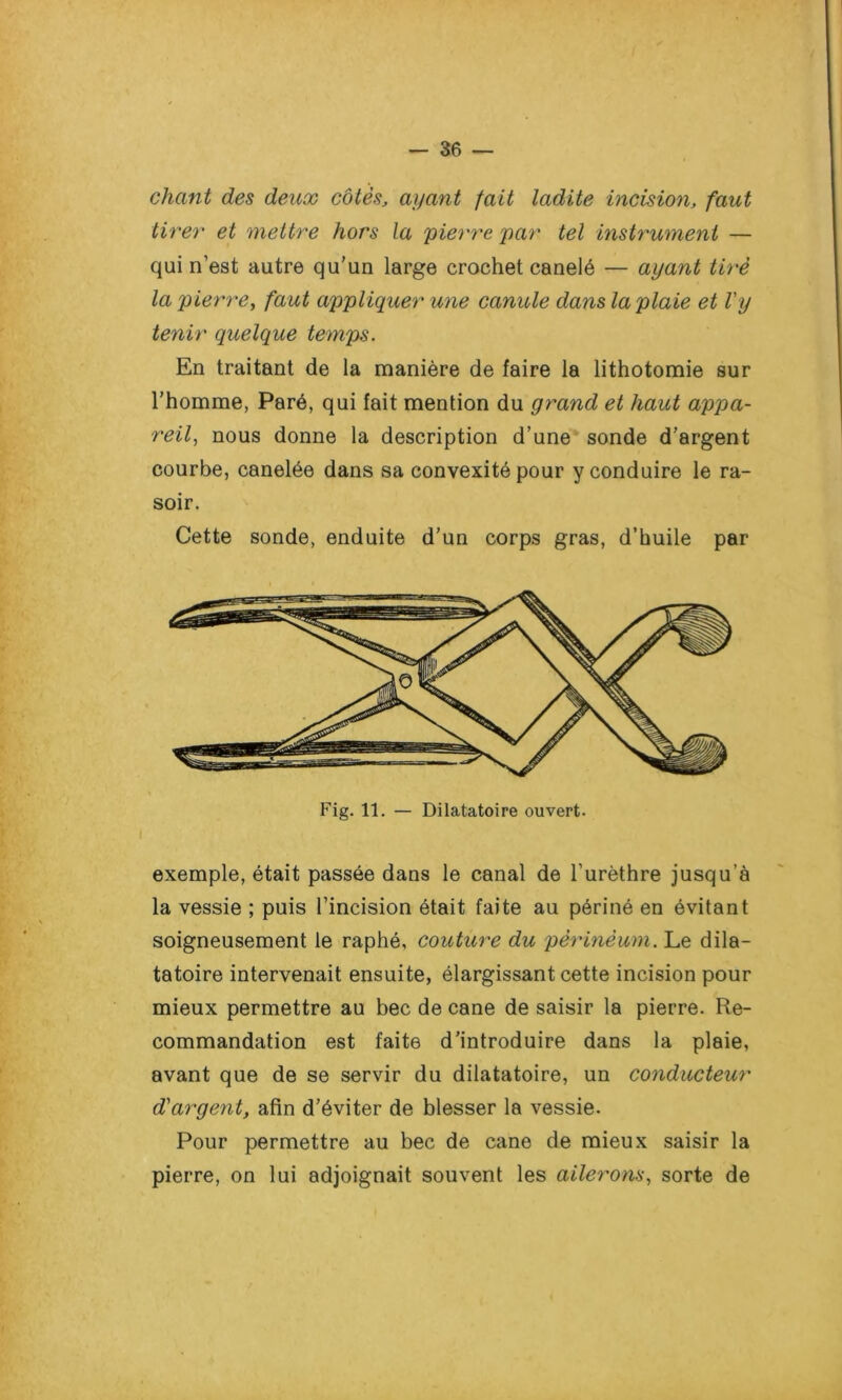 chant des deux cotes, ayant fait ladite incision, faut tirer• et mettre hors la pierre par tel instrument — qui n’est autre qu’un large crochet canelé — ayant tiré la pierref faut appliquer une canule dans la plaie et l'y tenir quelque temps. En traitant de la manière de faire la lithotomie sur l’homme, Paré, qui fait mention du grand et haut appa- reil, nous donne la description d’une sonde d’argent courbe, canelée dans sa convexité pour y conduire le ra- soir. Cette sonde, enduite d’un corps gras, d’huile par Fig. 11. — Dilatatoire ouvert. exemple, était passée dans le canal de l’urèthre jusqu’à la vessie ; puis l’incision était faite au périné en évitant soigneusement le raphé, couture du pèrinèum. Le dila- tatoire intervenait ensuite, élargissant cette incision pour mieux permettre au bec de cane de saisir la pierre. Re- commandation est faite d’introduire dans la plaie, avant que de se servir du dilatatoire, un conducteur d'argent, afin d’éviter de blesser la vessie. Pour permettre au bec de cane de mieux saisir la pierre, on lui adjoignait souvent les ailerons, sorte de