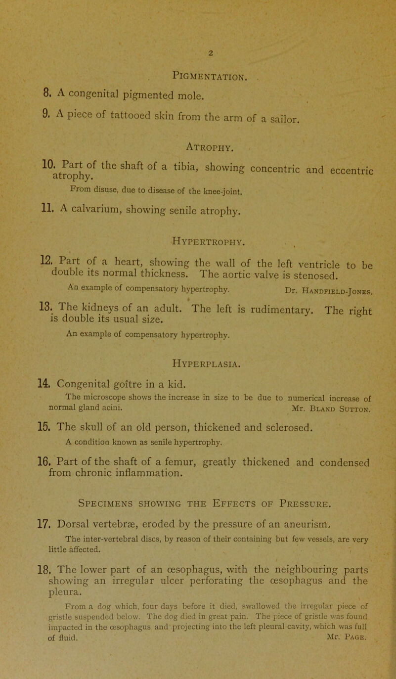 2 Pigmentation. 8. A congenital pigmented mole. 9. A piece of tattooed skin from the arm of a sailor. Atrophy. 10. Part of the shaft of a tibia, showing concentric and eccentric atrophy. From disuse, due to disease of the knee-joint. 11. A calvarium, showing senile atrophy. Hypertrophy. 12. Part of a heart, showing the wall of the left ventricle to be double its normal thickness. The aortic valve is stenosed. An example of compensatory hypertrophy. Dr. Handfield-Jones. 13. The kidneys of an adult. The left is rudimentary. The riffht is double its usual size. An example of compensatory hypertrophy. Hyperplasia. 14. Congenital goitre in a kid. The microscope shows the increase in size to be due to numerical increase of normal gland acini. Mr. Bland Sutton. 15. The skull of an old person, thickened and sclerosed. A condition known as senile hypertrophy. 16. Part of the shaft of a femur, greatly thickened and condensed from chronic inflammation. Specimens showing the Effects of Pressure. 17. Dorsal vertebras, eroded by the pressure of an aneurism. The inter-vertebral discs, by reason of their containing but few vessels, are very little affected. 18. The lower part of an oesophagus, with the neighbouring parts showing an irregular ulcer perforating the oesophagus and the pleura. From a dog which, four days before it died, swallowed the irregular piece of gristle suspended below. The dog died in great pain. The piece of gristle was found impacted in the oesophagus and projecting into the left pleural cavity, which was full of fluid. Mr. Page.