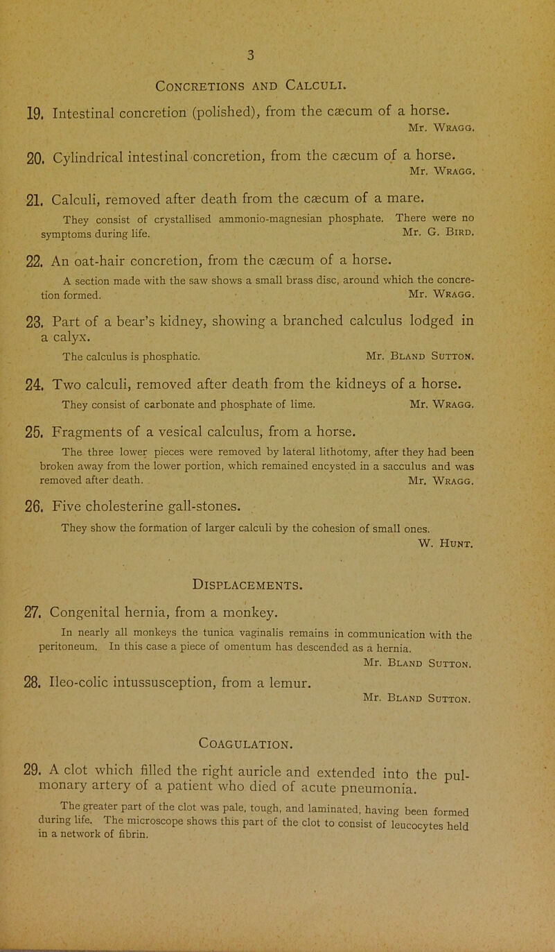 Concretions and Calculi. 19. Intestinal concretion (polished), from the caecum of a horse. Mr. Wragg. 20. Cylindrical intestinal concretion, from the caecum of a horse. Mr. Wragg. 21. Calculi, removed after death from the caecum of a mare. They consist of crystallised ammonio-magnesian phosphate. There were no symptoms during life. Mr. G. Bird. 22. An oat-hair concretion, from the caecum of a horse. A section made with the saw shows a small brass disc, around which the concre- tion formed. Mr. Wragg. 23. Part of a bear’s kidney, showing a branched calculus lodged in a calyx. The calculus is phosphatic. Mr. Bland Sutton. 24. Two calculi, removed after death from the kidneys of a horse. They consist of carbonate and phosphate of lime. Mr. Wragg. 25. Fragments of a vesical calculus, from a horse. The three lower pieces were removed by lateral lithotomy, after they had been broken away from the lower portion, which remained encysted in a sacculus and was removed after death. Mr. Wragg. 26. Five cholesterine gall-stones. They show the formation of larger calculi by the cohesion of small ones. W. Hunt. Displacements. 27. Congenital hernia, from a monkey. In nearly all monkeys the tunica vaginalis remains in communication with the peritoneum. In this case a piece of omentum has descended as a hernia. Mr. Bland Sutton. 28. Ileo-colic intussusception, from a lemur. Mr. Bland Sutton. Coagulation. 29. A clot which filled the right auricle and extended into the pul- monary artery of a patient who died of acute pneumonia. The greater part of the clot was pale, tough, and laminated, having been formed during life. The microscope shows this part of the clot to consist of leucocytes held in a network of fibrin.