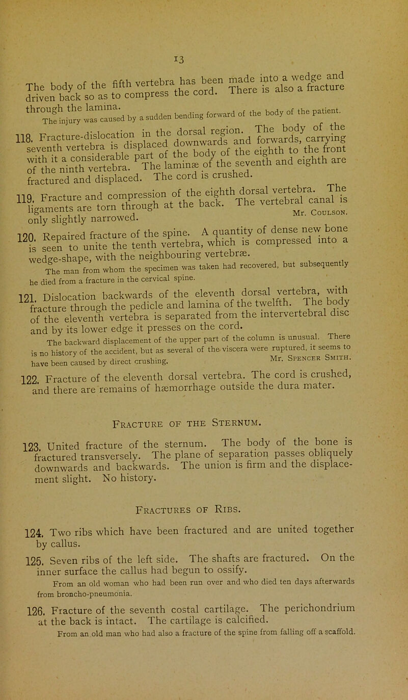 The body of the fifth vertebra has be driven back so as to compress the thrTh?t‘r;~a hr a sudden heading of the hodg ot .he pabenh 118. Fracture-dislocation in the foraards,'carrying seventh vertebia is displa eighth to the front only slightly narrowed. 19(1 Repaired fracture of the spine. A quantity of dense new bone is seen to unite the tenth vertebra, which is compressed into wedge-shape, with the neighbouring vertebrae. The man from whom the specimen was taken had recovered, but subsequently he died from a fracture in the cervical spine. 121 Dislocation backwards of the eleventh dorsal vertebra, with ^ fracture through the pedicle and lamina of the twelfth. The body of the eleventh vertebra is separated from the intervertebral disc and by its lower edge it presses on the cord. The backward displacement of the upper part of the column is unusual. There is no history of the accident, but as several of the. viscera were ruptured, it seems to have been caused by direct crushing. Mr. Spencer Smith. 122 Fracture of the eleventh dorsal vertebra.. The cord is crushed, and there are remains of hemorrhage outside the dura mater. Fracture of the Sternum. 123. United fracture of the sternum. The body of the bone is fractured transversely. The plane of separation passes obliquely downwards and backwards. The union is firm and the displace- ment slight. No history. Fractures of Ribs. 124. Two ribs which have been fractured and are united together by callus. 125. Seven ribs of the left side. The shafts are fractured. On the inner surface the callus had begun to ossify. From an old woman who had been run over and who died ten days afterwards from broncho-pneumonia. 126. Fracture of the seventh costal cartilage. The perichondrium at the back is intact. The cartilage is calcified. From an old man who had also a fracture of the spine from falling off a scaffold.