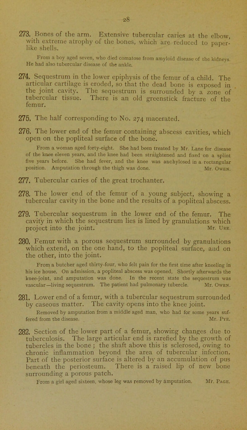 273. Bones of the arm. Extensive tubercular caries at the elbow, with extreme atrophy of the bones, which are reduced to paper- like shells. From a boy aged seven, who died comatose from amyloid disease of the kidneys. He had also tubercular disease of the ankle. 274. Sequestrum in the lower epiphysis of the femur of a child. The articular cartilage is eroded, so that the dead bone is exposed in the joint cavity. The sequestrum is surrounded by a zone of tubercular tissue. There is an old greenstick fracture of the femur. 275. The half corresponding to No. 274 macerated. 276. The lower end of the femur containing abscess cavities, which open on the popliteal surface of the bone. From a woman aged forty-eight. She had been treated by Mr. Lane for disease of the knee eleven years, and the knee had been straightened and fixed on a splint five years before. She had fever, and the knee was anchylosed in a rectangular position. Amputation through the thigh was done. Mr. Owen. 277. Tubercular caries of the great trochanter. 278. The lower end of the femur of a young subject, showing a tubercular cavity in the bone and the results of a popliteal abscess. 279. Tubercular sequestrum in the lower end of the femur. The cavity in which the sequestrum lies is lined by granulations which project into the joint. Mr. Ure. 280. Femur with a porous sequestrum surrounded by granulations which extend, on the one hand, to the popliteal surface, and on the other, into the joint. From a butcher aged thirty-four, who felt pain for the first time after kneeling in his ice house. On admission, a popliteal abscess was opened, Shortly afterwards the knee-joint, and amputation was done. In the recent state the sequestrum was vascular—living sequestrum. The patient had pulmonary tubercle. Mr. Owen. 281. Lower end of a femur, with a tubercular sequestrum surrounded by caseous matter. The cavity opens into the knee joint. Removed by amputation from a middle aged man, who had for some years suf- fered from the disease. Mr. Pye. 282. Section of the lower part of a femur, showing changes due to tuberculosis. The large articular end is rarefied by the growth of tubercles in the bone ; the shaft above this is sclerosed, owing to chronic inflammation beyond the area of tubercular infection. Part of the posterior surface is altered by an accumulation of pus beneath the periosteum. There is a raised lip of new bone surrounding a porous patch. From a girl aged sixteen, whose leg was removed by amputation. Mr. Page.