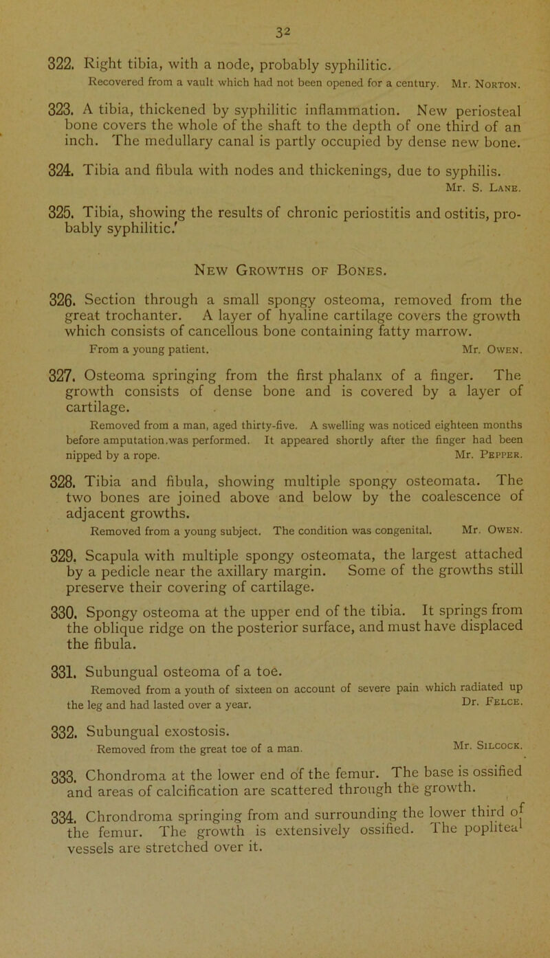 322. Right tibia, with a node, probably syphilitic. Recovered from a vault which had not been opened for a century. Mr. Norton. 323. A tibia, thickened by syphilitic inflammation. New periosteal bone covers the whole of the shaft to the depth of one third of an inch. The medullary canal is partly occupied by dense new bone. 324. Tibia and fibula with nodes and thickenings, due to syphilis. Mr. S. Lane. 325. Tibia, showing the results of chronic periostitis and ostitis, pro- bably syphilitic.' New Growths of Bones. 326. Section through a small spongy osteoma, removed from the great trochanter. A layer of hyaline cartilage covers the growth which consists of cancellous bone containing fatty marrow. From a young patient. Mr. Owen. 327. Osteoma springing from the first phalanx of a finger. The growth consists of dense bone and is covered by a layer of cartilage. Removed from a man, aged thirty-five. A swelling was noticed eighteen months before amputation.was performed. It appeared shortly after the finger had been nipped by a rope. Mr. Pepper. 328. Tibia and fibula, showing multiple spongy osteomata. The two bones are joined above and below by the coalescence of adjacent growths. Removed from a young subject. The condition was congenital. Mr. Owen. 329. Scapula with multiple spongy osteomata, the largest attached by a pedicle near the axillary margin. Some of the growths still preserve their covering of cartilage. 330. Spongy osteoma at the upper end of the tibia. It springs from the oblique ridge on the posterior surface, and must have displaced the fibula. 331. Subungual osteoma of a toe. Removed from a youth of sixteen on account of severe pain the leg and had lasted over a year. which radiated up Dr. Felce. 332. Subungual exostosis. Removed from the great toe of a man. Silcock. 333. Chondroma at the lower end of the femur. The base is ossified and areas of calcification are scattered through the growth. 334. Chrondroma springing from and surrounding the lower third of the femur. The growth is extensively ossified. 1 he poplitea vessels are stretched over it.